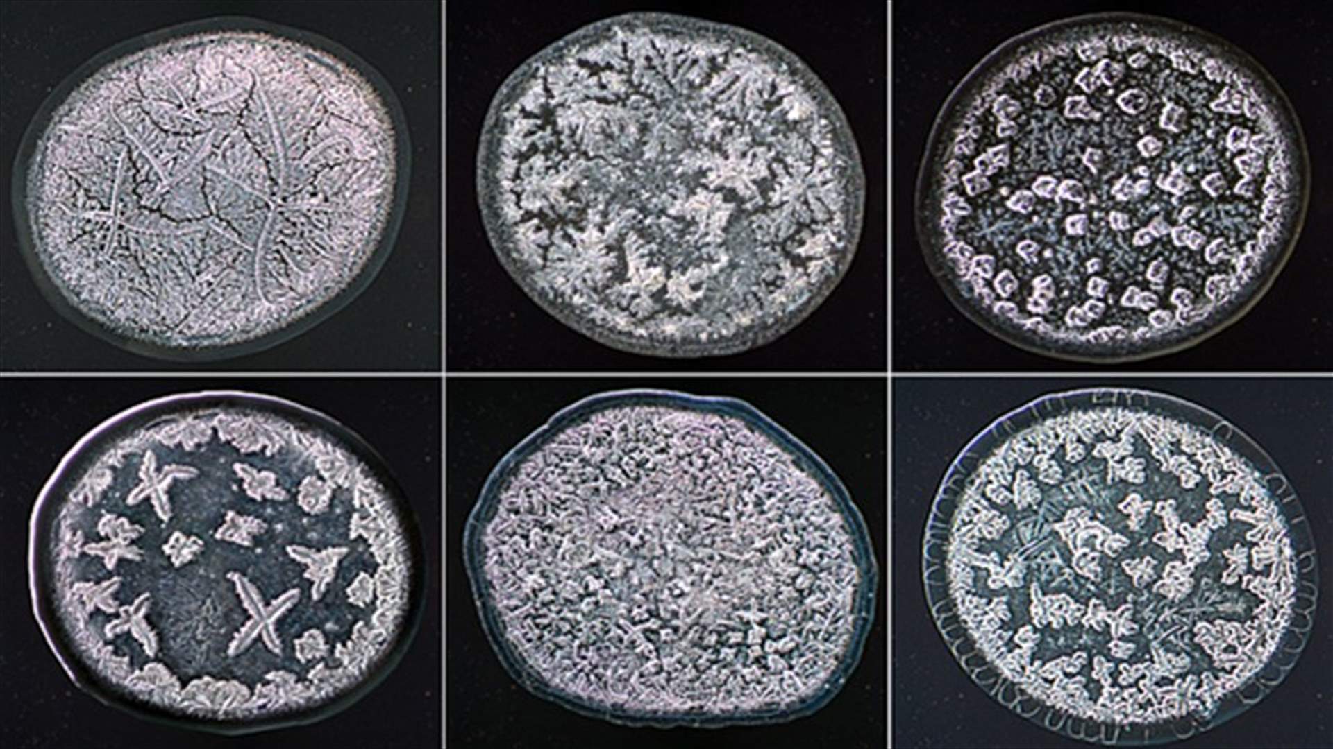 [PHOTOS] The Inner Beauty Of Tears As They Appear Under A Microscope