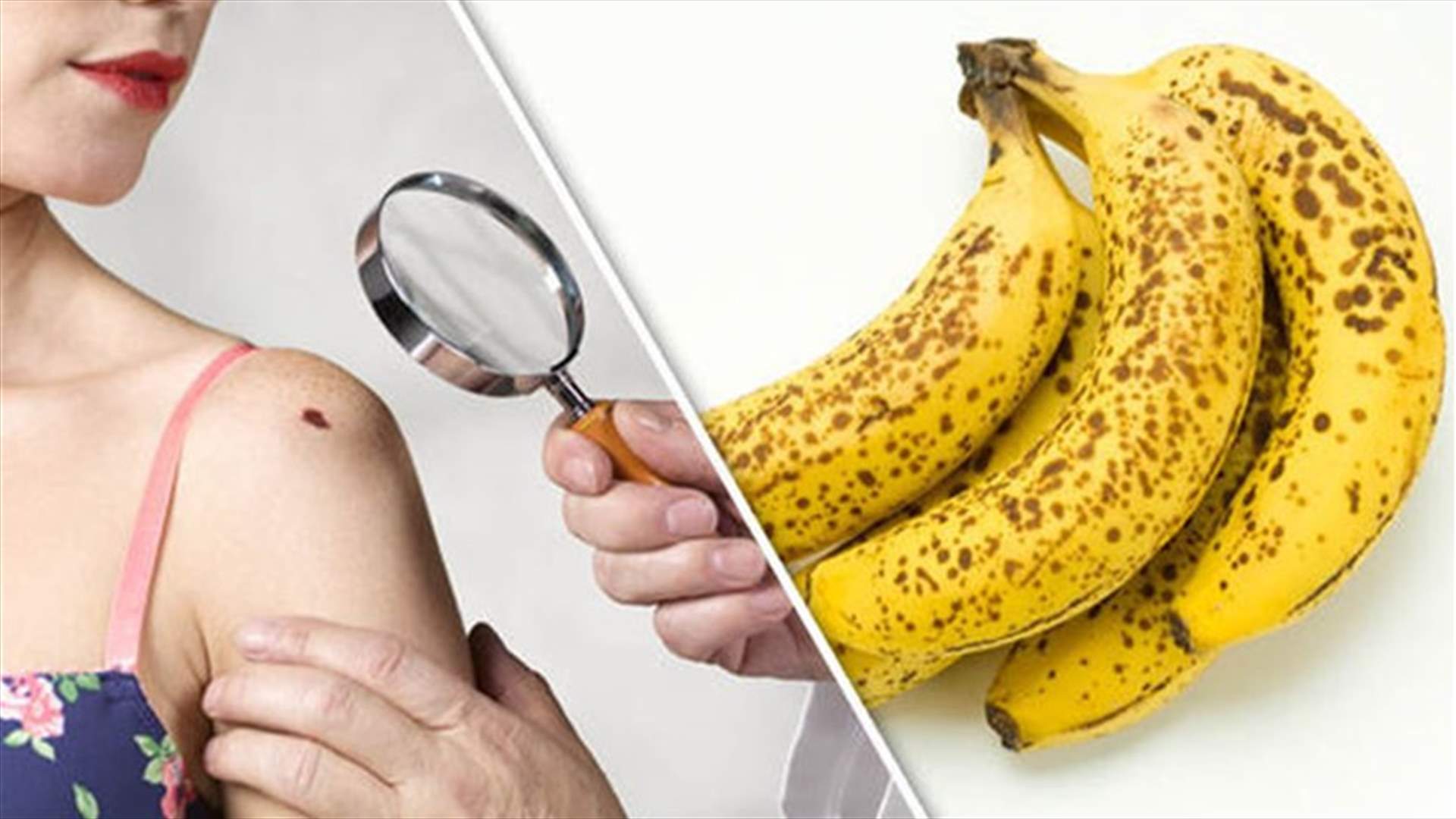 فائدة مُذهلة للبقع السوداء على الموز