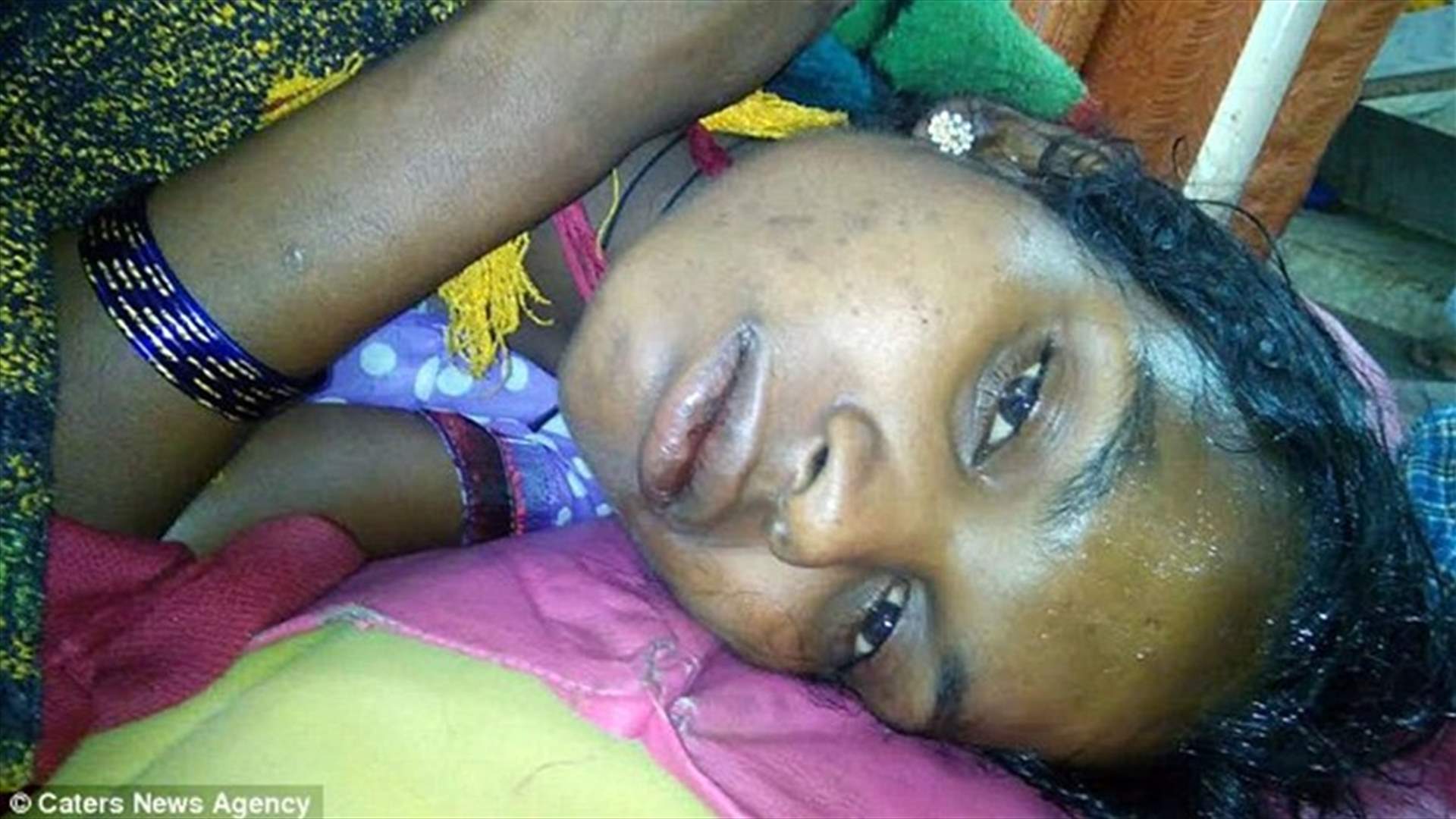 ظنّت أنها حامل بطفلة... فما هي المفاجأة التي حصلت عند الولادة؟
