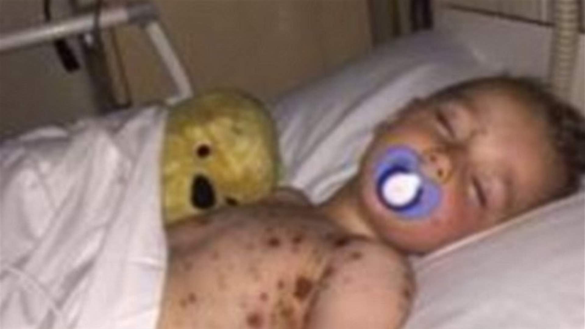 دواء مضاد للالتهابات أدى إلى تسمّم دمه!