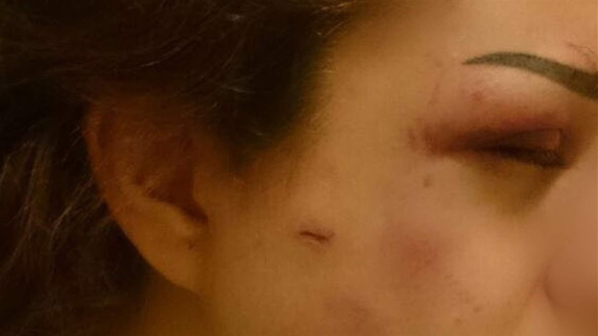 [PHOTOS] Woman rescued from abusive husband