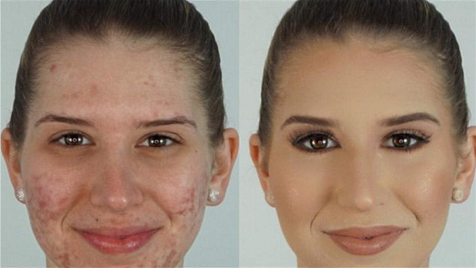 بالفيديو: طريقة مثاليّة لإخفاء حبوب الوجه بتقنية عجلة الألون للمكياج