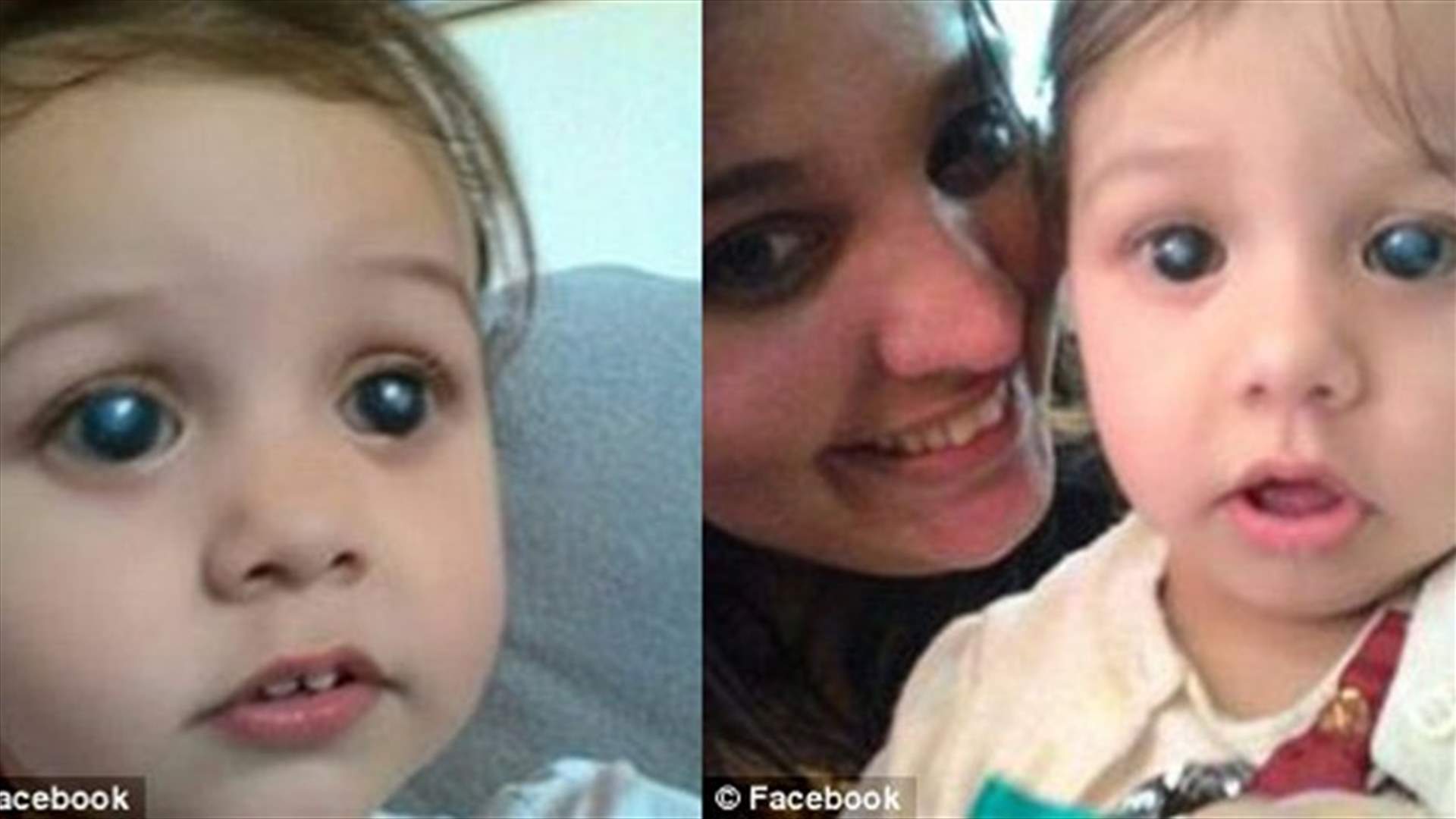 بالفيديو: طفلة ترى والدتها وتسمعها للمرّة الأولى