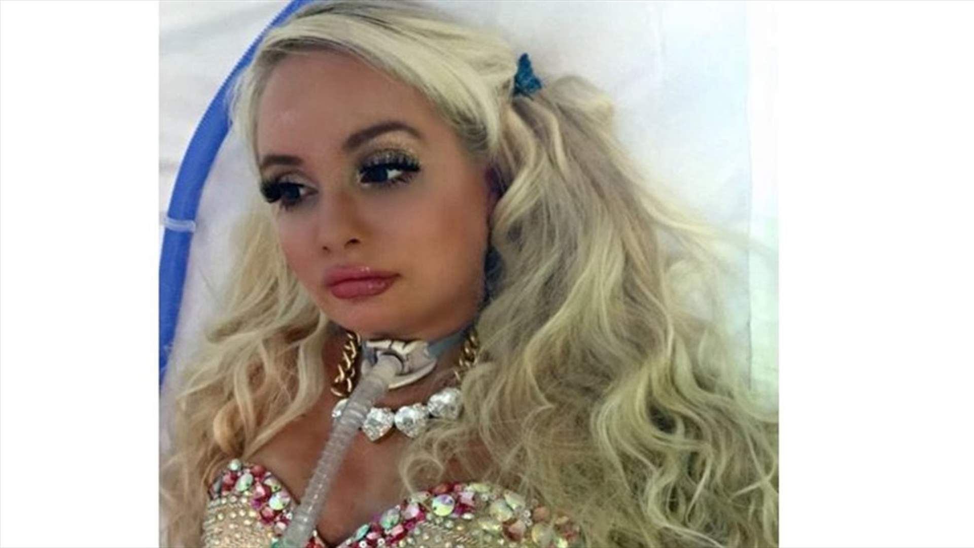 بالصوّر: أوّل باربي بشريّة مشلولة في العالم
