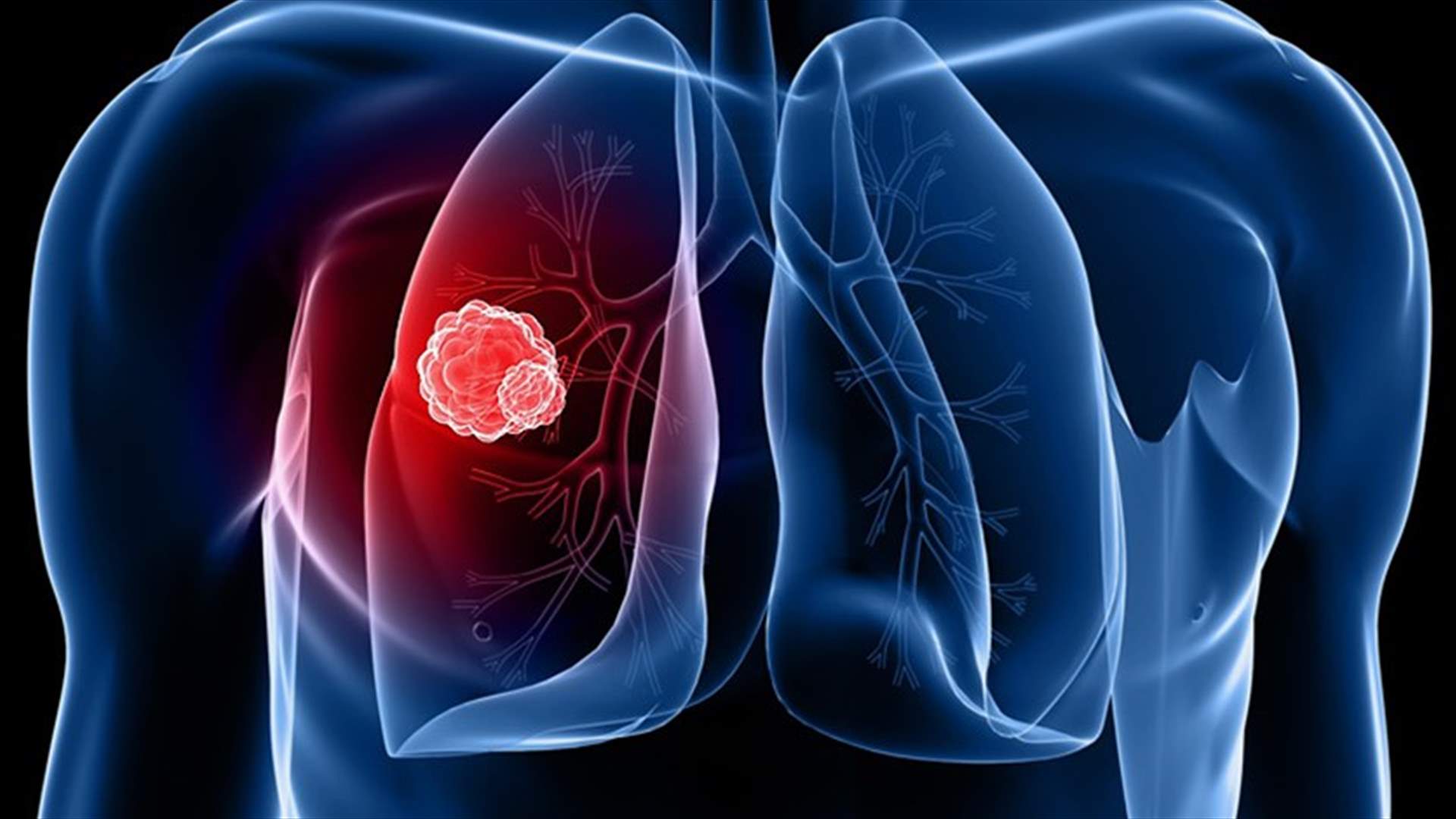 هذا النوع من الأعشاب يحمي من سرطان الرئة