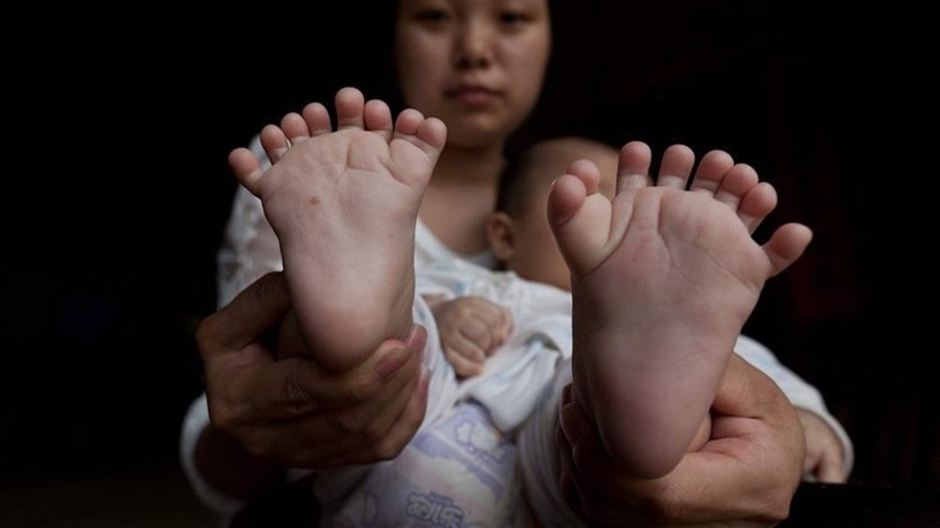 بالصور: ولادة طفل صيني بـ 31 إصبعاً في يديه وقدميه!