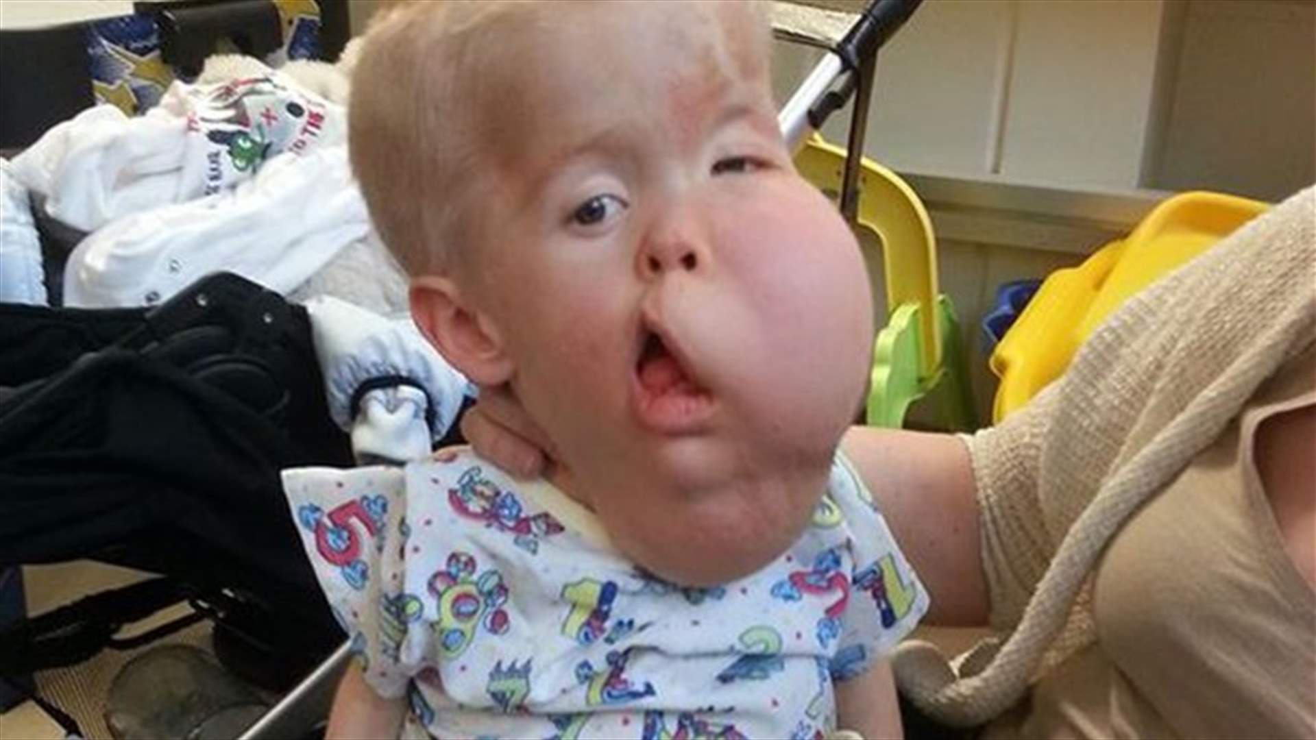 وفاة طفل بحالةٍ نادرة لا تُصيب إلا واحد في 50 مليون