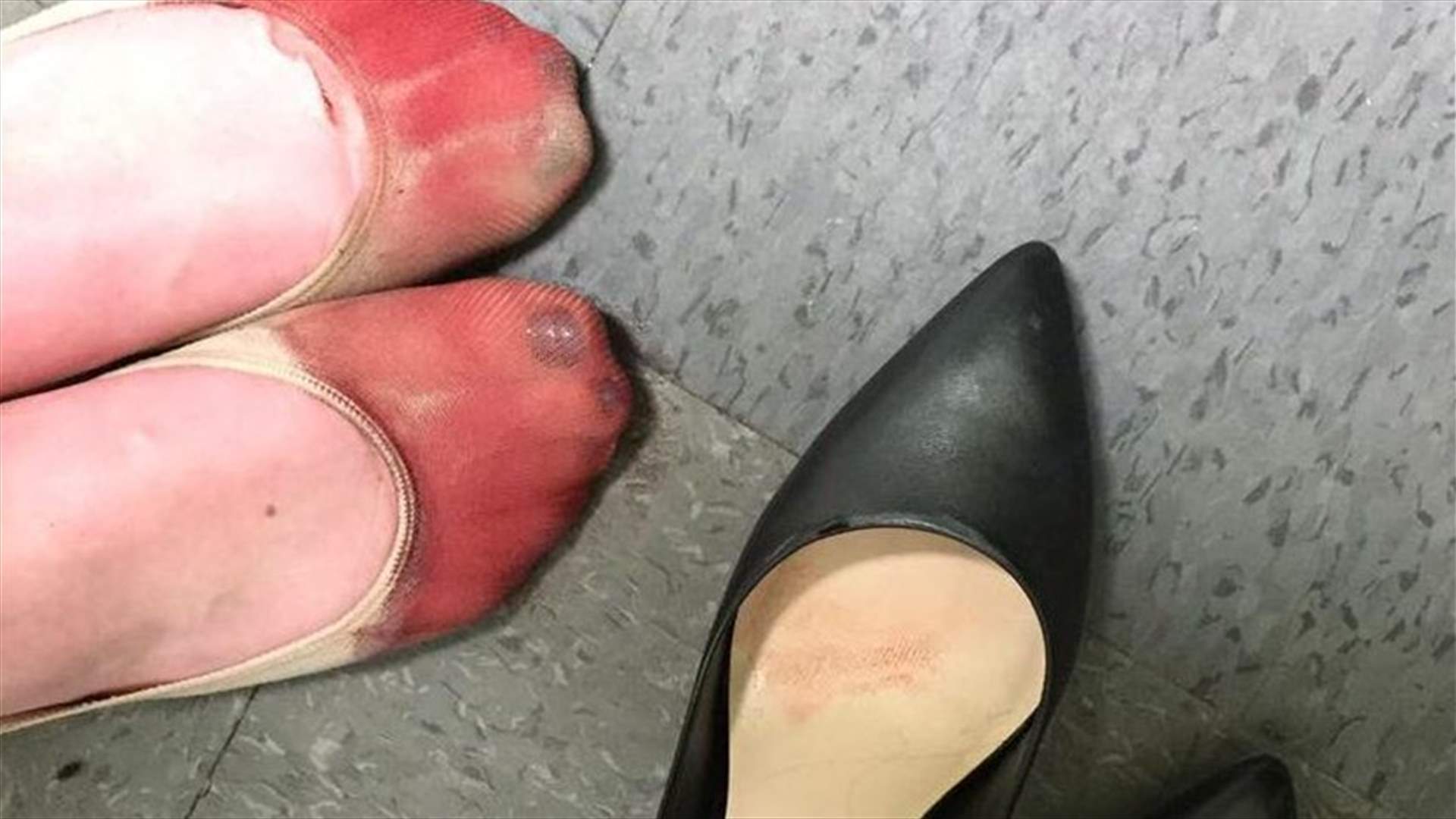 نادلة بنزيفٍ في قدميها تُجبَر على ارتداء الكعب العالي خلال العمل