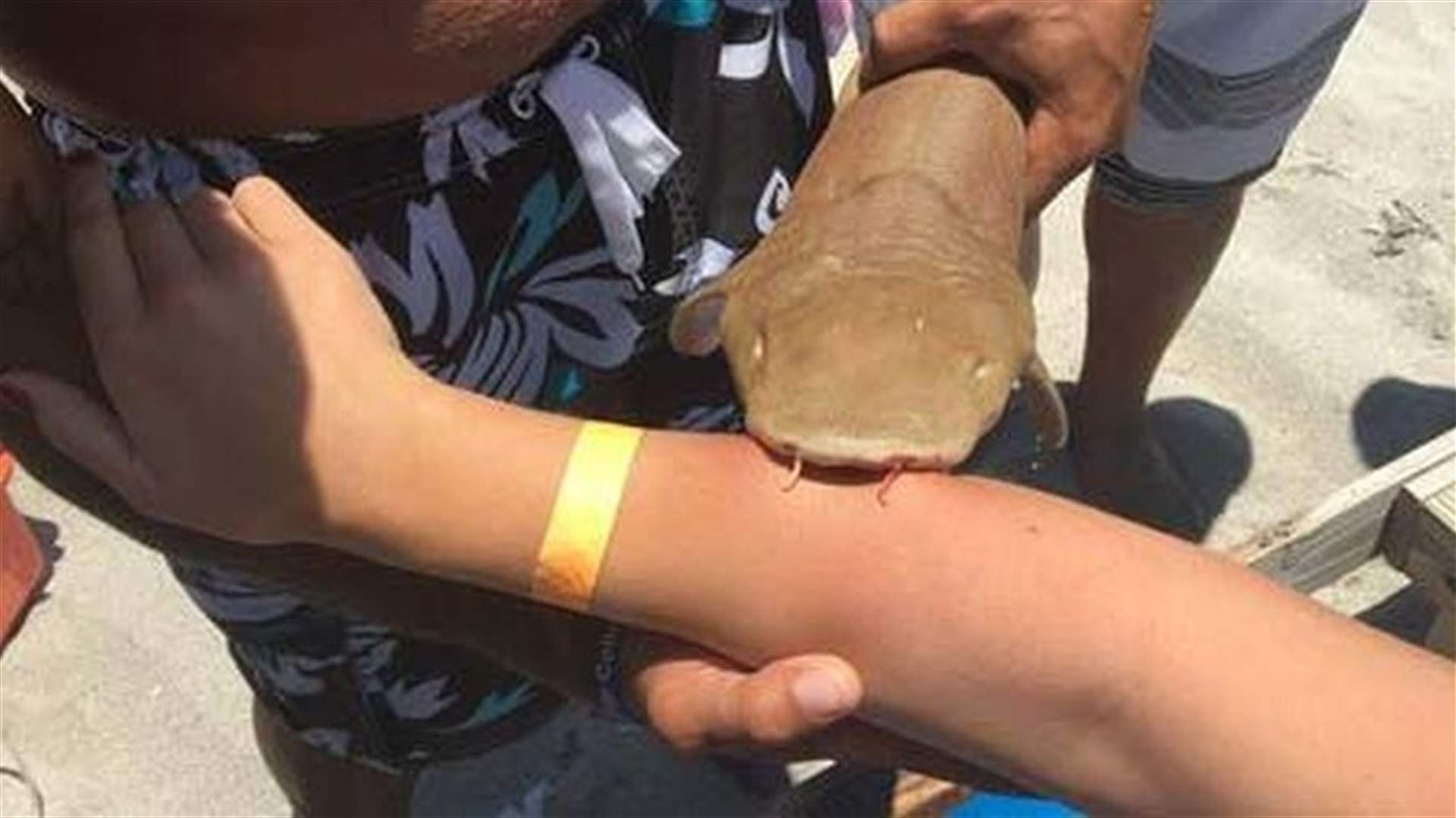 بالصوّر: عضّها القرش في يدها فنقلت معه إلى المستشفى!