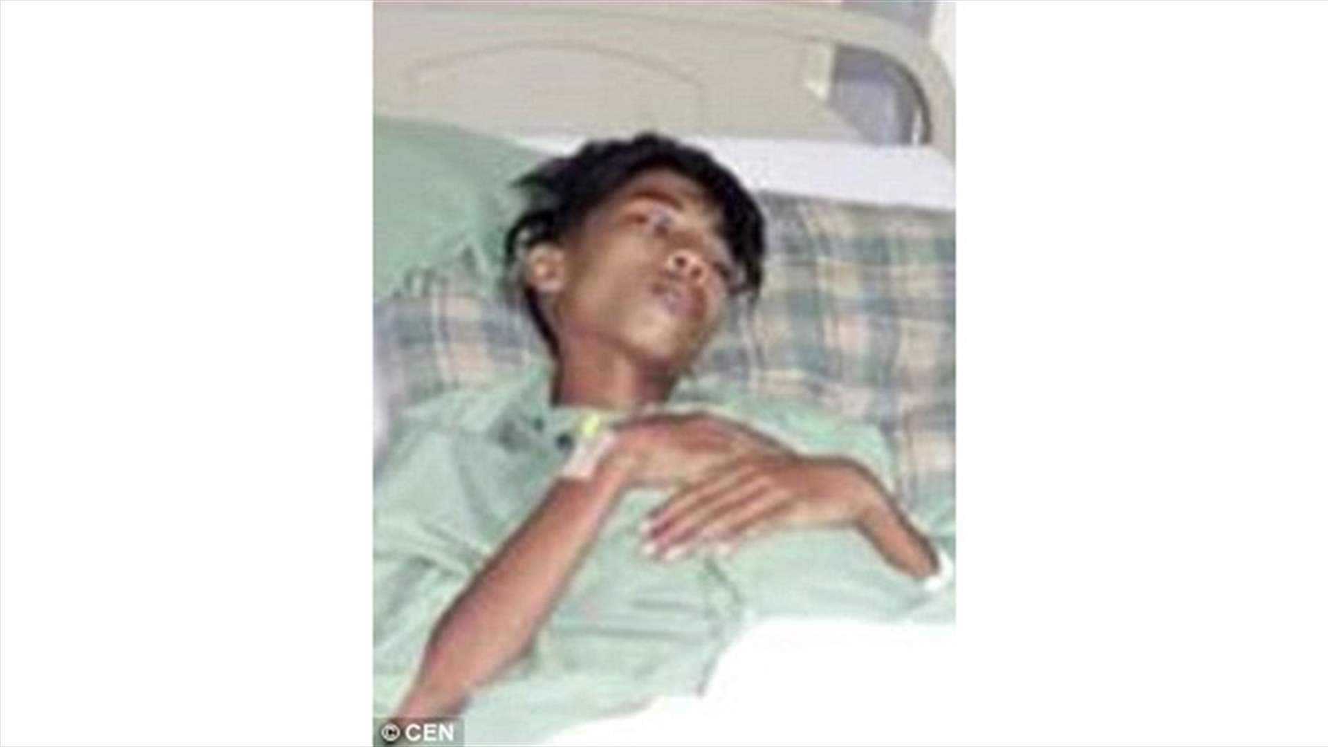 بالصورة: استخرجوا من معدته شقيقه التوأم!