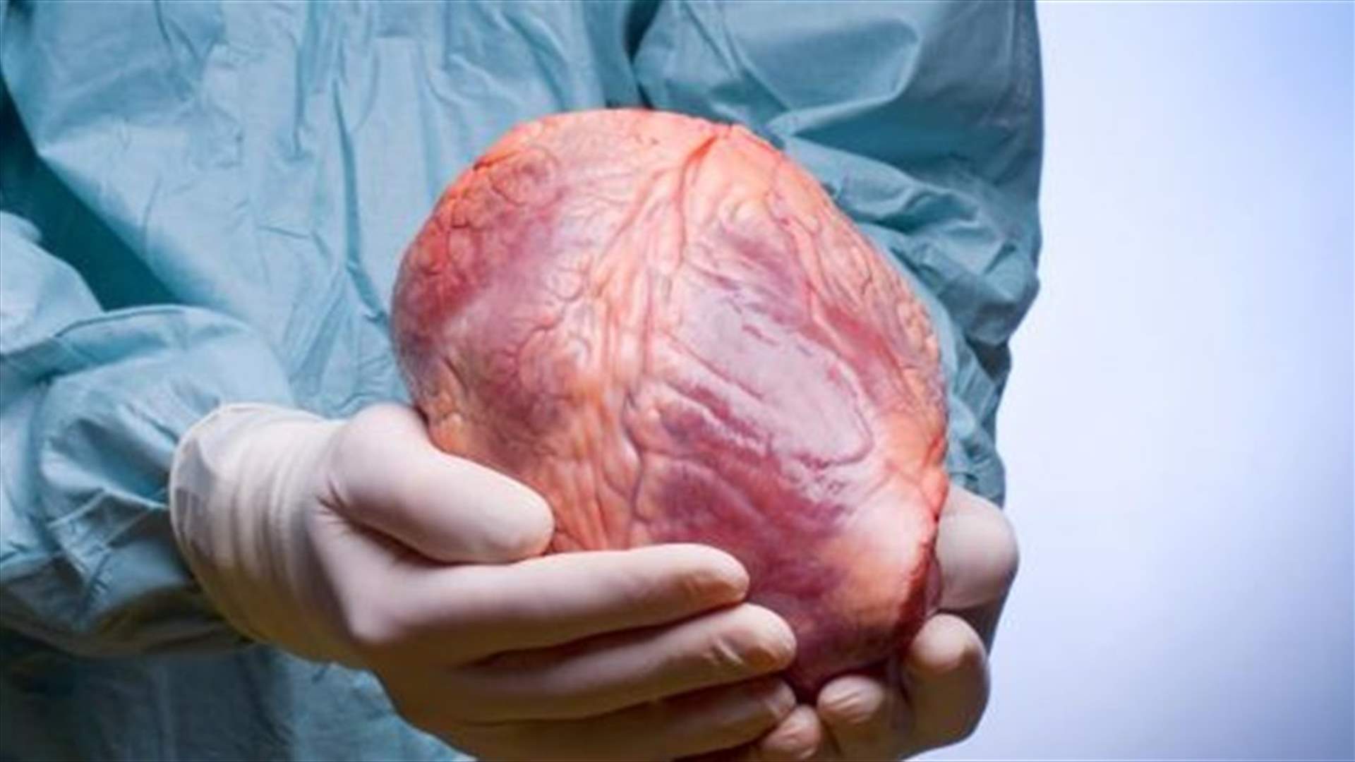 وهب الأعضاء أصبح واقعا في لبنان 