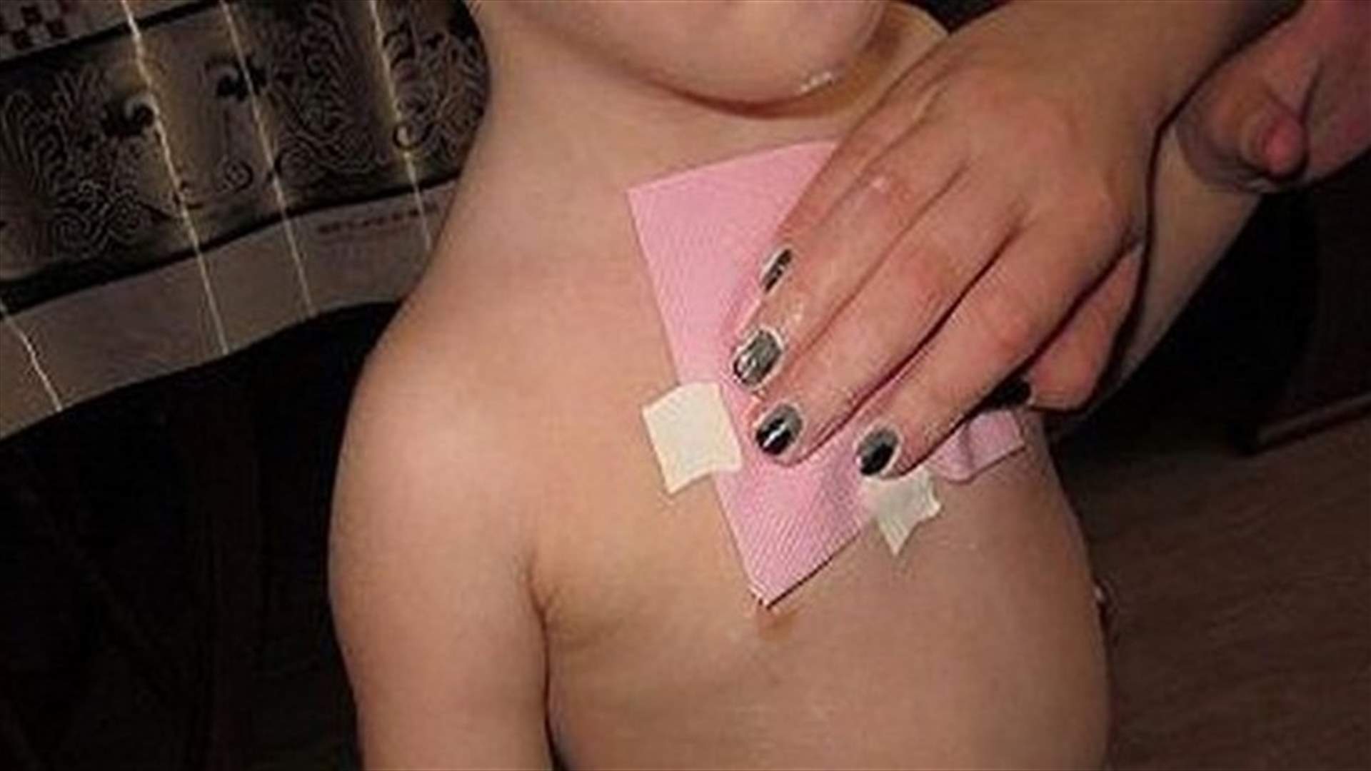 ضمادات العسل لعلاج السعال في ليلة واحدة!
