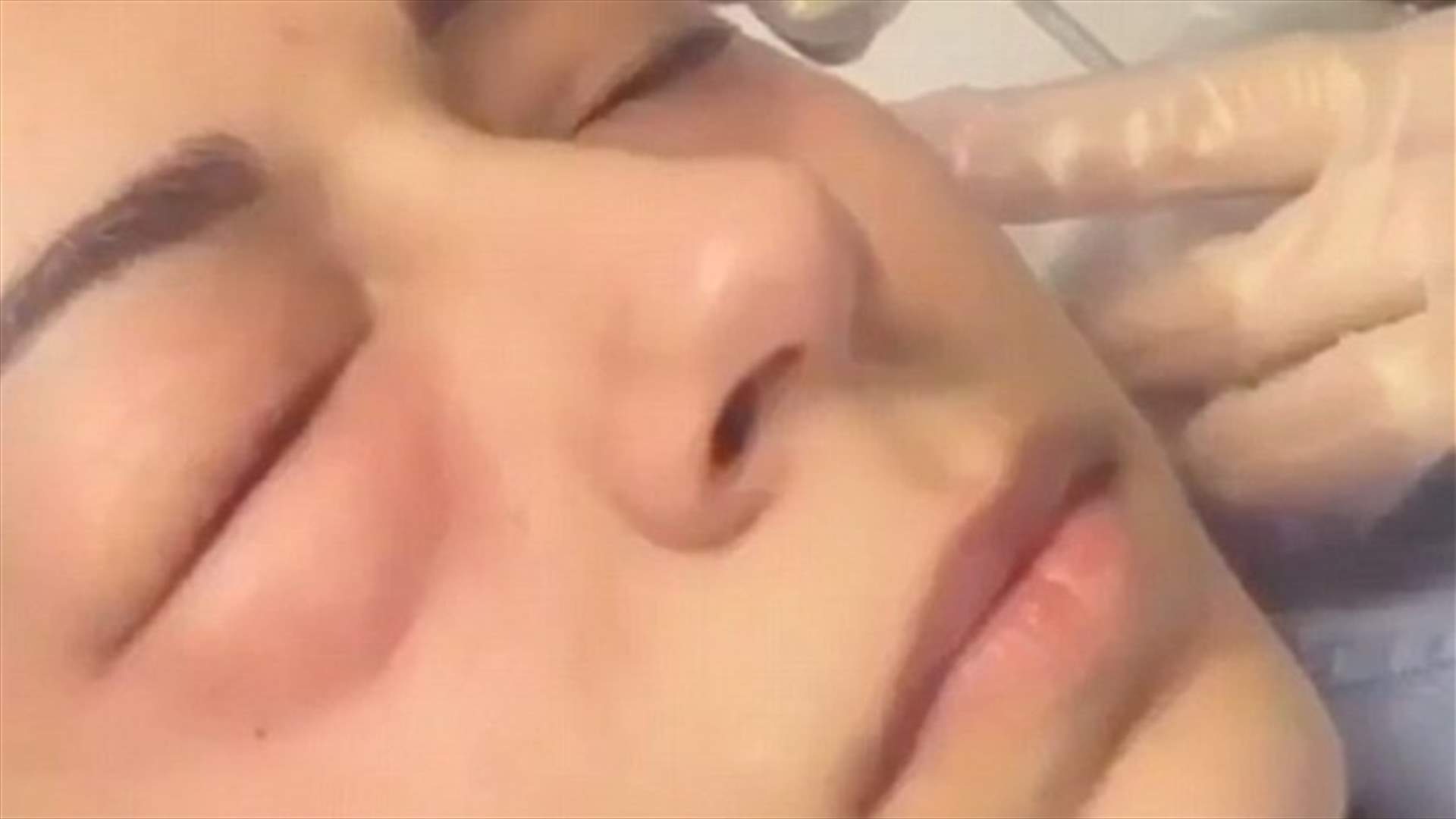 ماذا يحصل عند حقن محيط العينين بثاني أكسيد الكربون؟