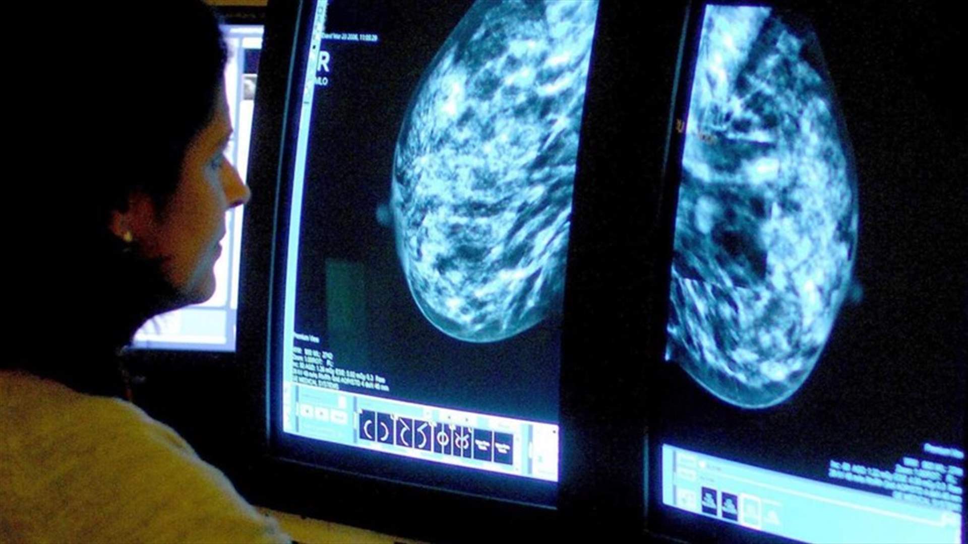 أمل جديد للنساء المعرضات للإصابة بسرطان الثدي!