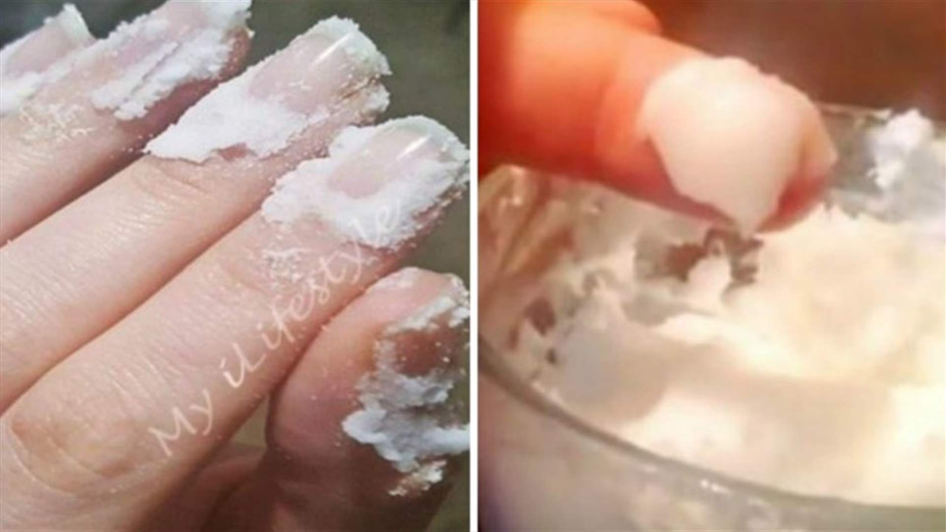 ماذا يحصل عند فرك الأظافر بصودا الخبز؟