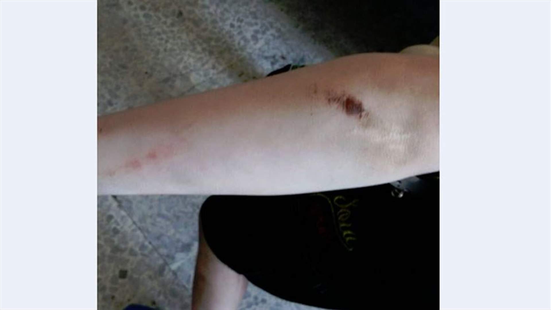بالصورة: طفل في الرابعة يتعرض للضرب من قبل والده 