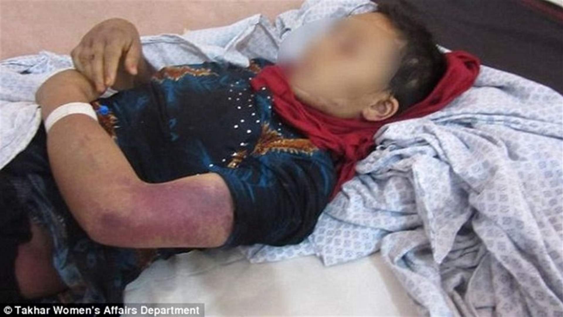 ضرب زوجته الحامل بمساعدة من والدته وشقيقته... فخسرت جنينها