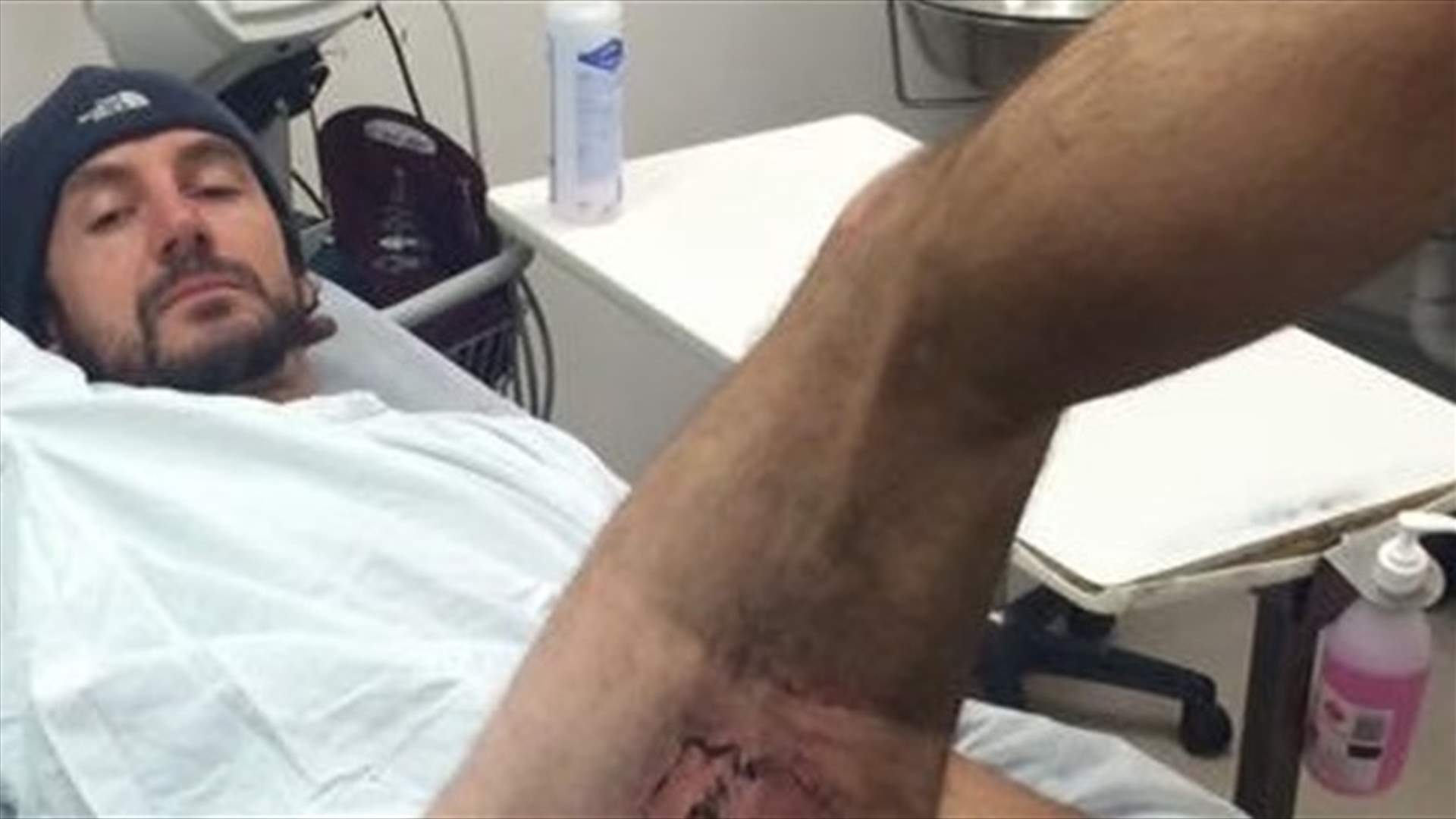 بالصورة: هاتف أيفون تسبّب له بحروق من الدرجة الثالثة!