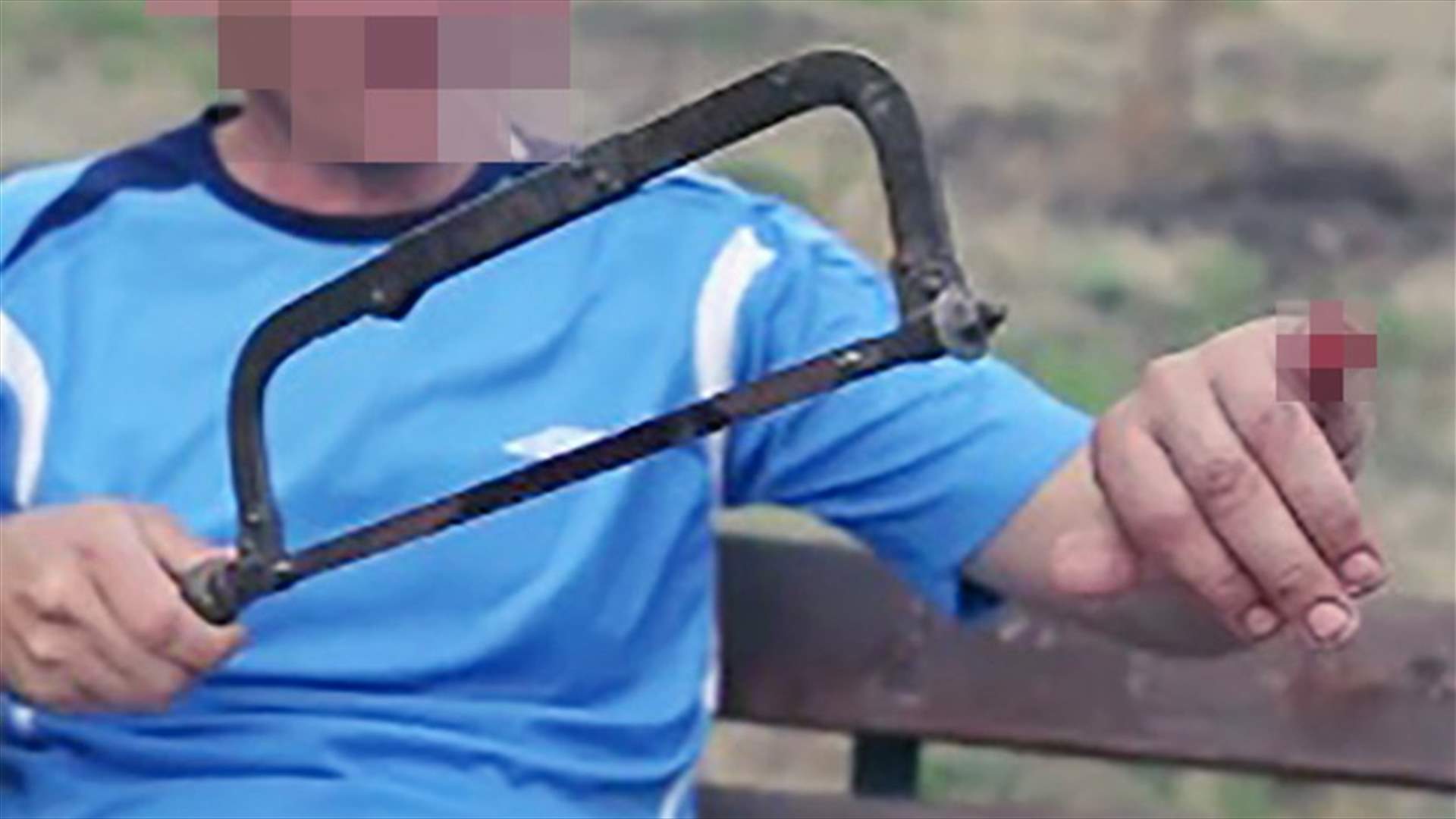 روسيّ قرّر قطع أصابع يديه... فما السبب؟