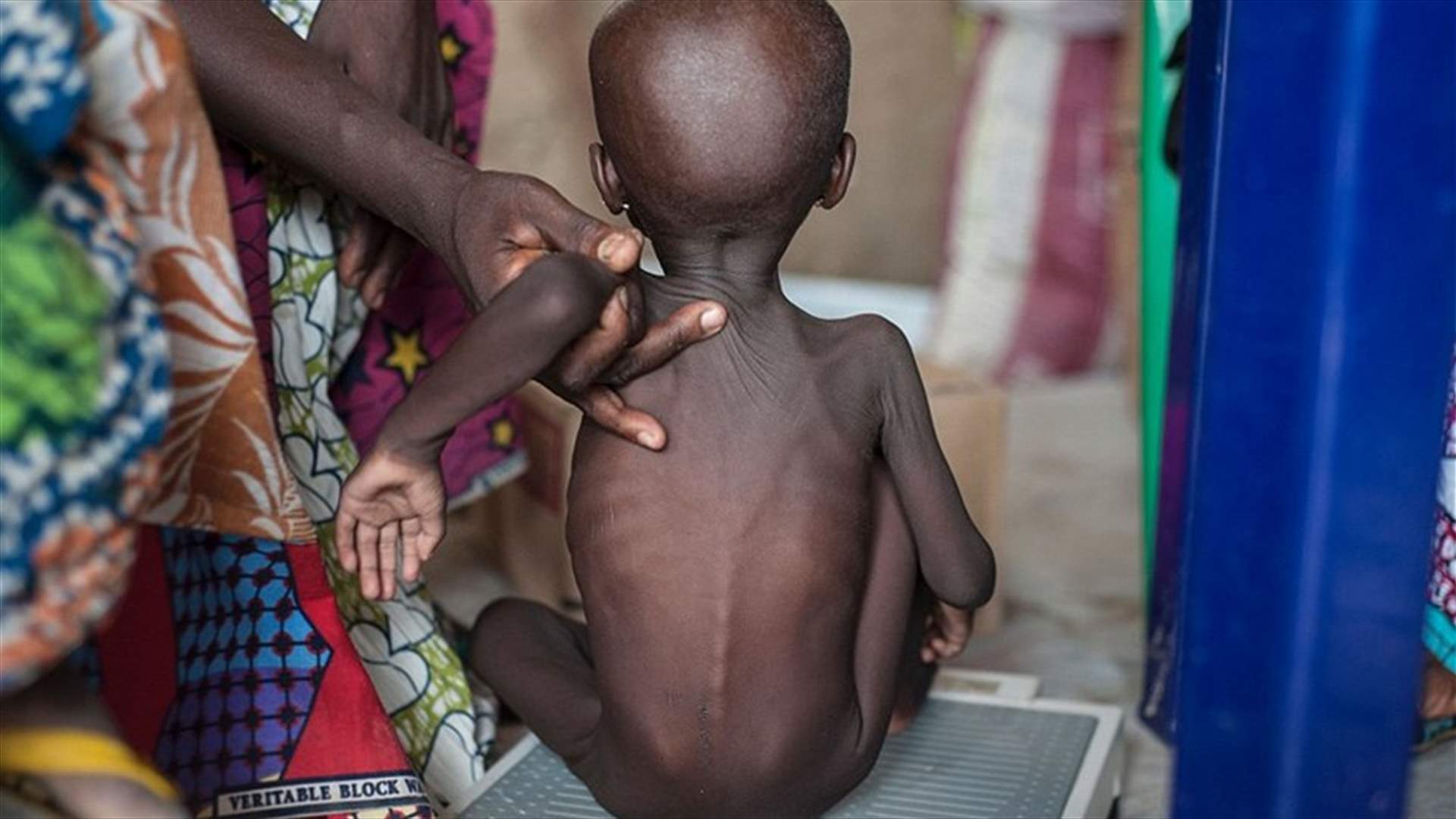 يونيسيف: 49 ألف طفل مهددون بالموت في نيجيريا