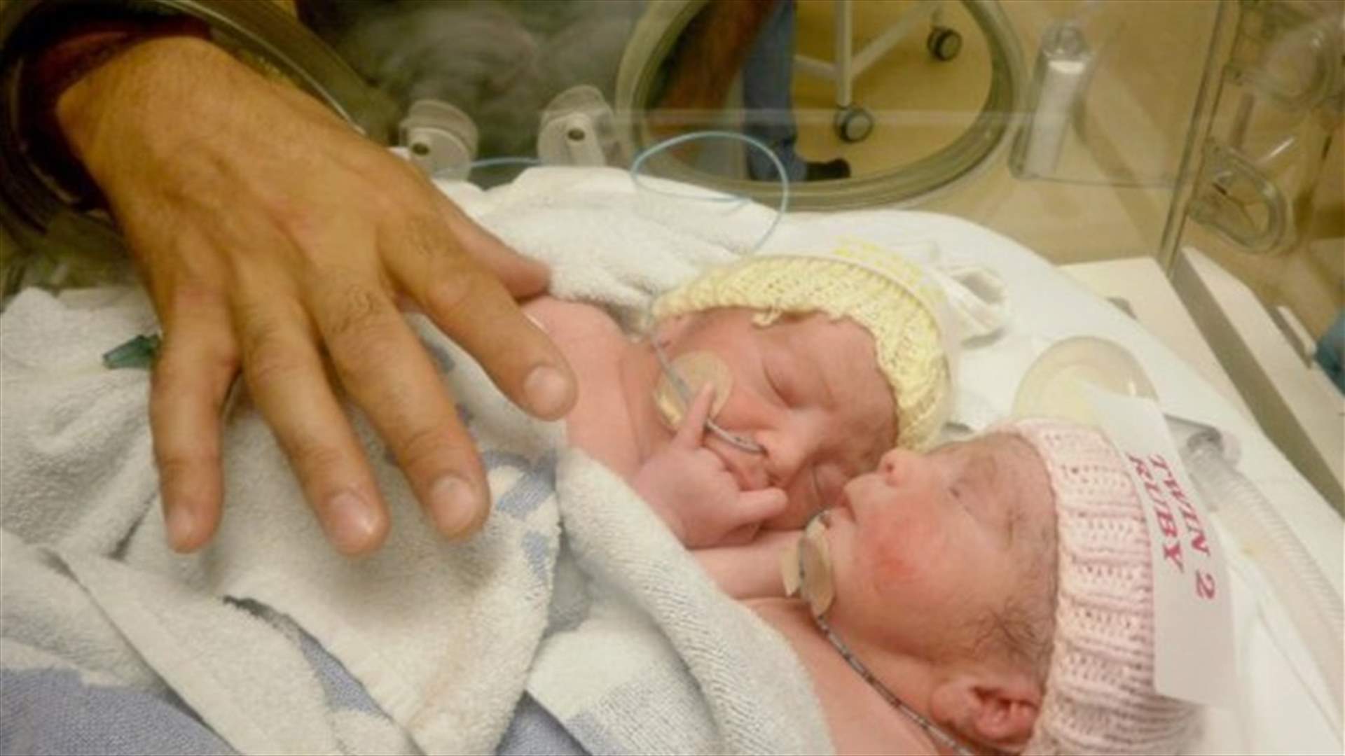 صور رائعة لتوأمين بريطانيين تمّ فصلهما عند الولادة... في أول يوم مدرسة لهما