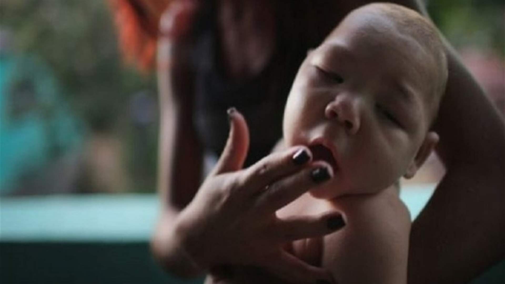 ماليزيا تسجل أول حالة عدوى محلية لفيروس زيكا