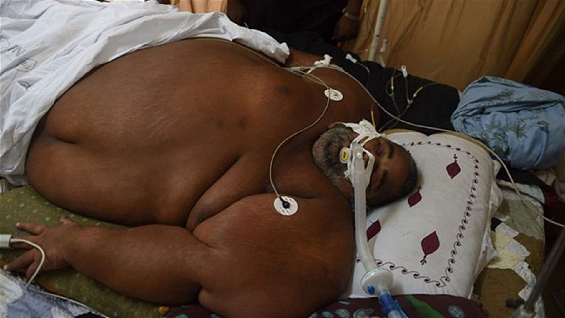 رجل بحالةٍ مرضية غامضة... يوقع الأطباء في حيرة