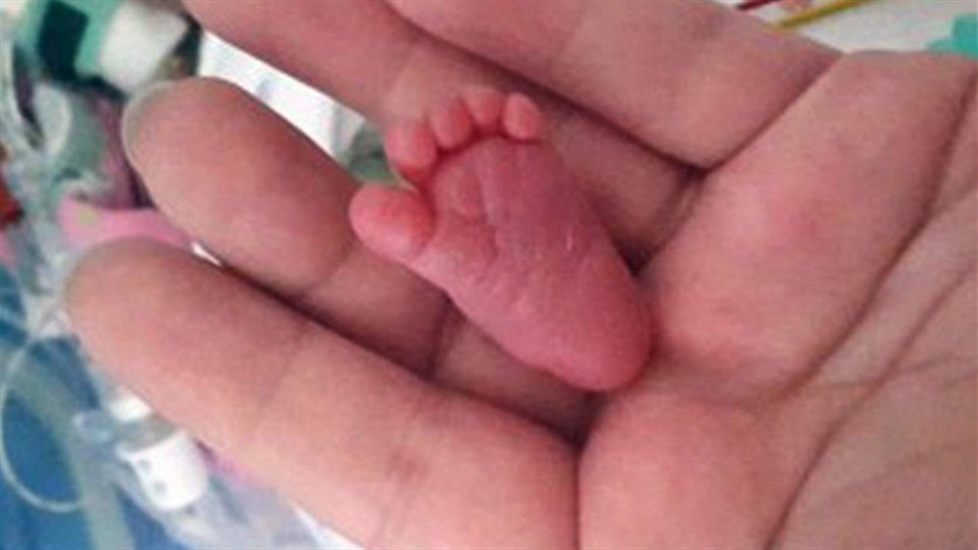 بالصورة: أصغر طفلة في العالم تحدّت كلّ التوقعات بمعجزة