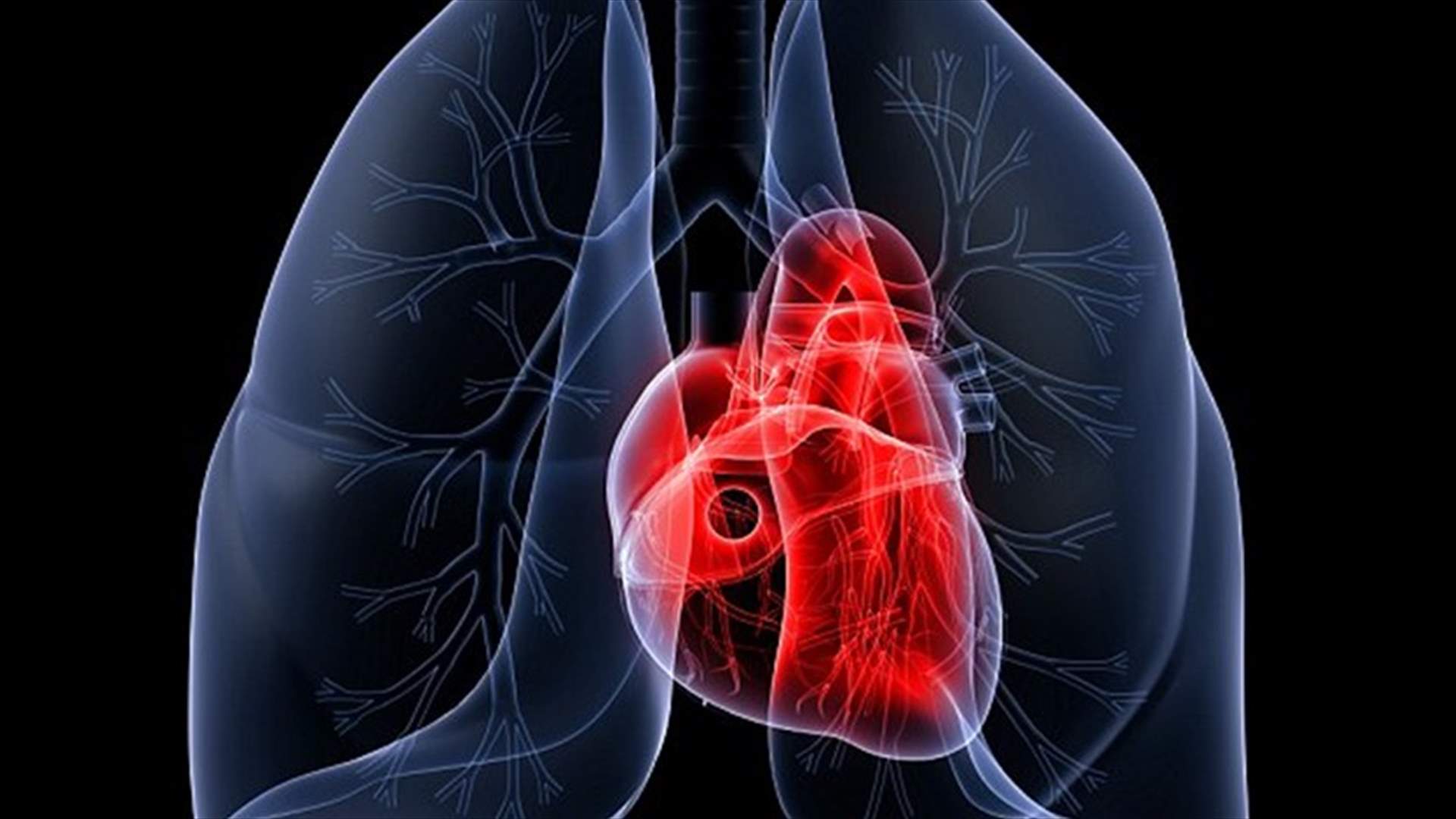 العقاقير المخفضة للكولسترول تحمي من النوبات القلبيّة والسكتات الدماغيّة