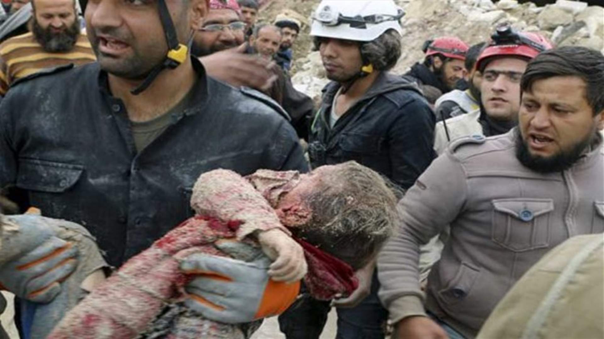 السعودية تتكفل بعلاج 150 طفلاً من مصابي حلب