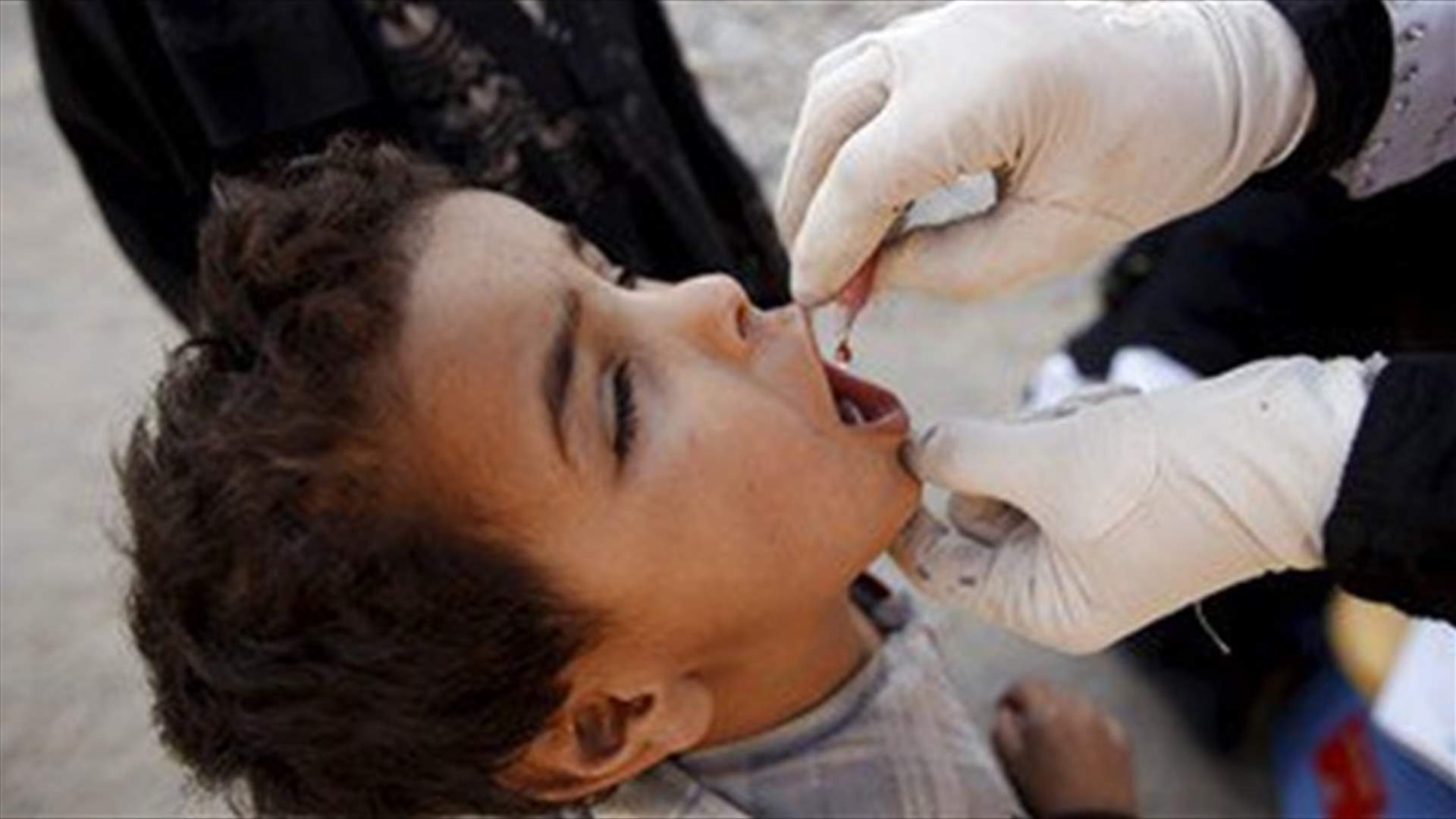 ظهور اصابات بوباء الكوليرا في اليمن