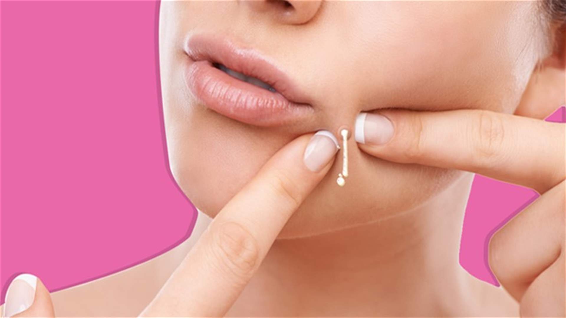 Don’t Be Alarmed, But Squeezing Your Spots Can Kill You