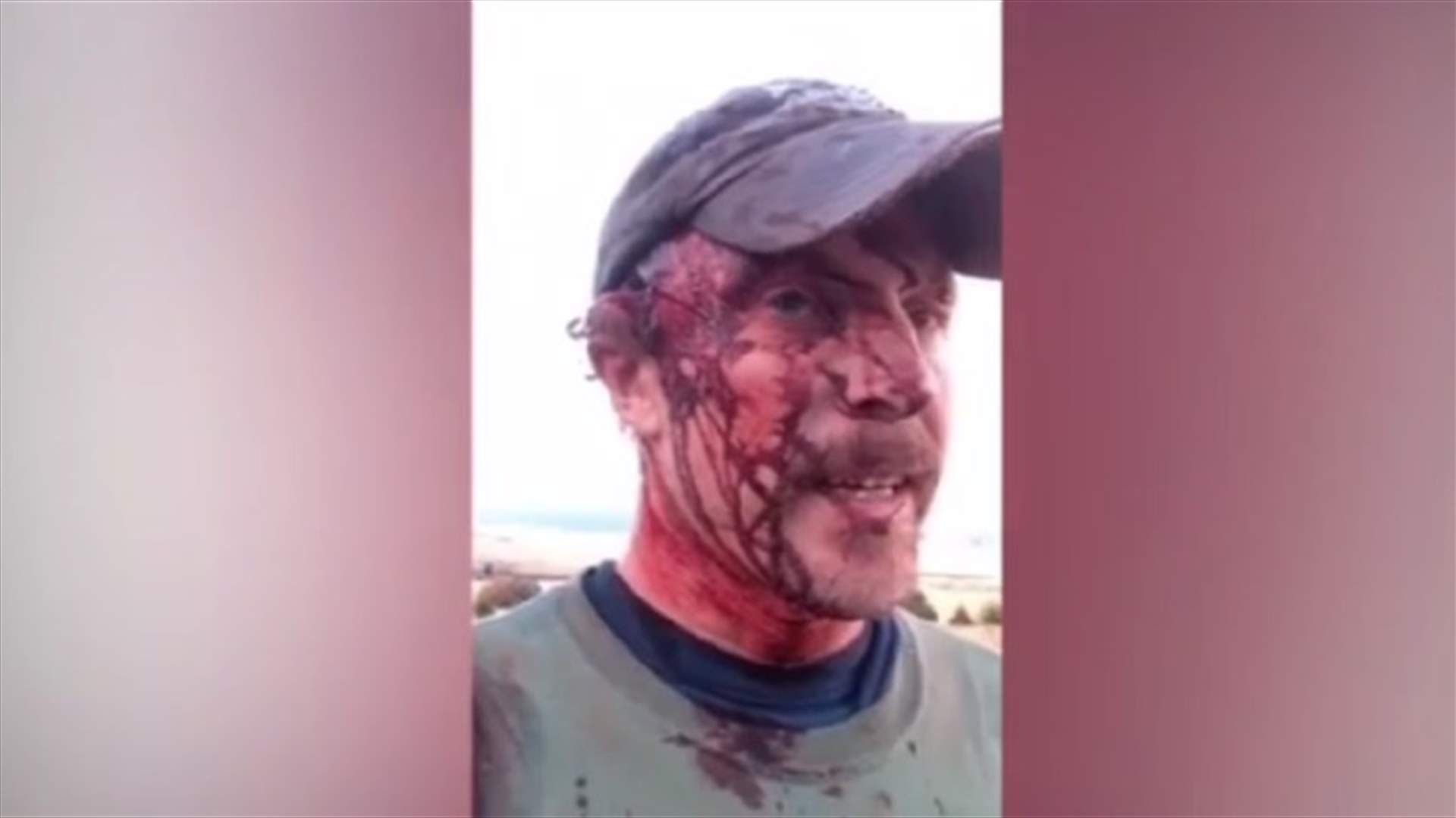 بالصور والفيديو: رجل يصور نفسه بعد تعرّضه لهجوم من قبل ثلاثة دببة