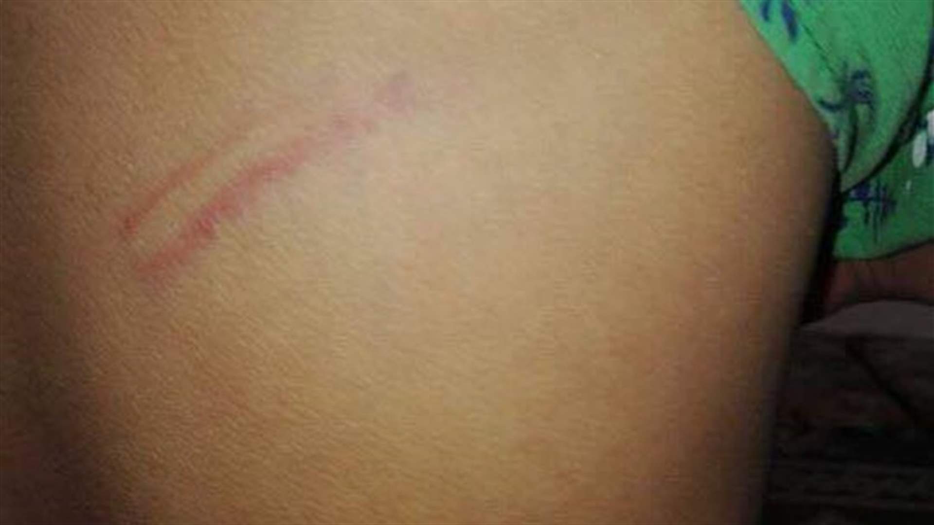 بالصور: طالب ابتدائي يتعرض للضرب على يد معلمته