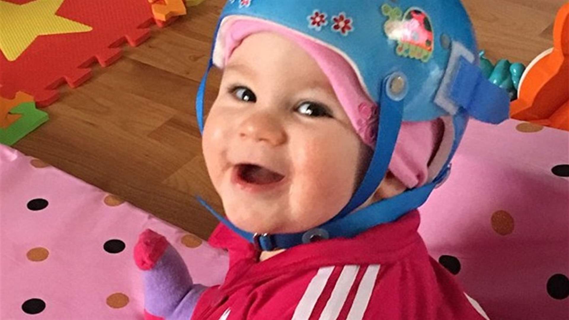 بالصور: ولدت بثقبٍ بحجم حبة الأفوكادو في جمجمتها!