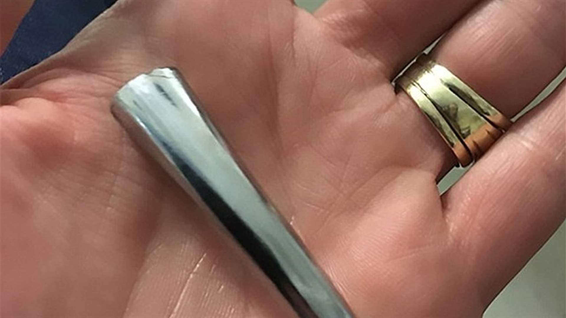 بالصورة: مقبض باب معدني يثقب عين طفل!