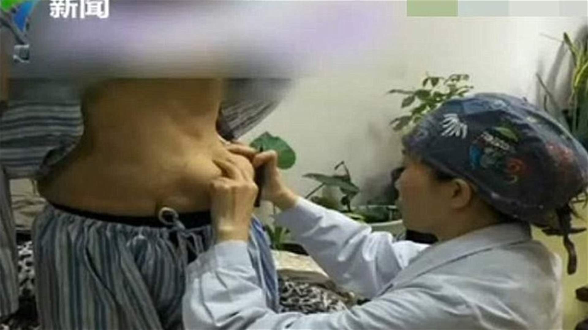 قامت بتكبير ثدييها... فنمت كتل غريبة في بطنها!
