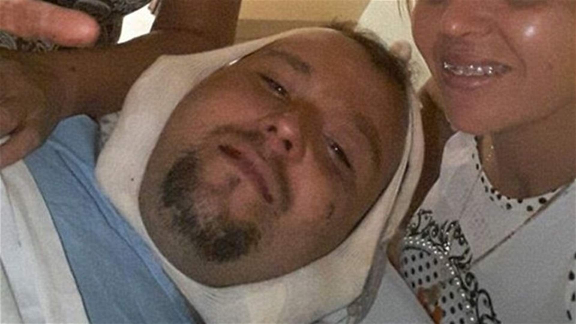 بالصورة: سهم اخترق رأسه أثناء رحلة صيد... لكنّه نجا!