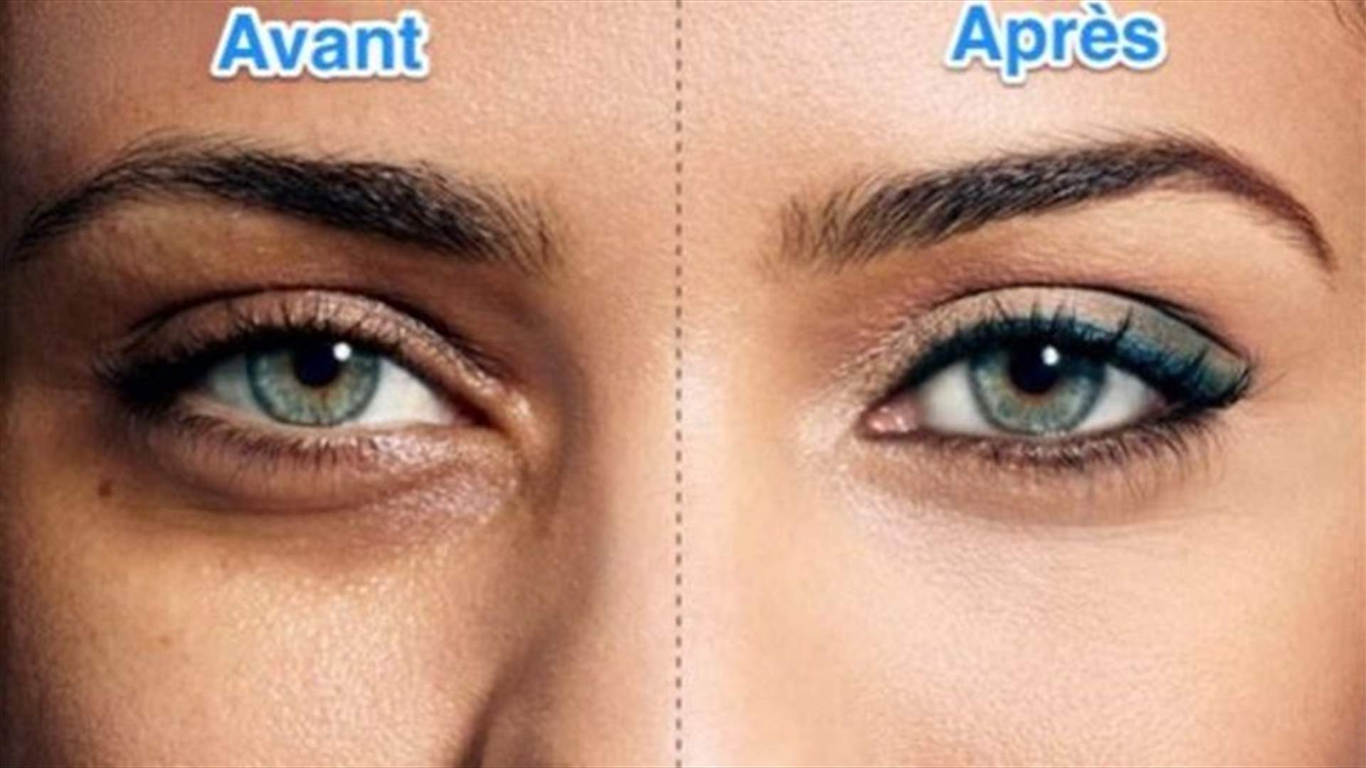 طرق منزلية للتخلّص من الهالات السوداء والانتفاخ حول العينين