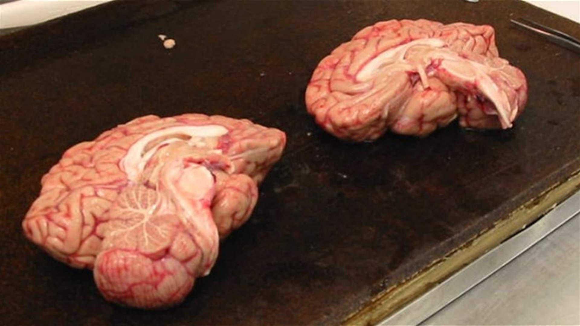 أهلًا بكم في أكبر بنك للأدمغة في العالم