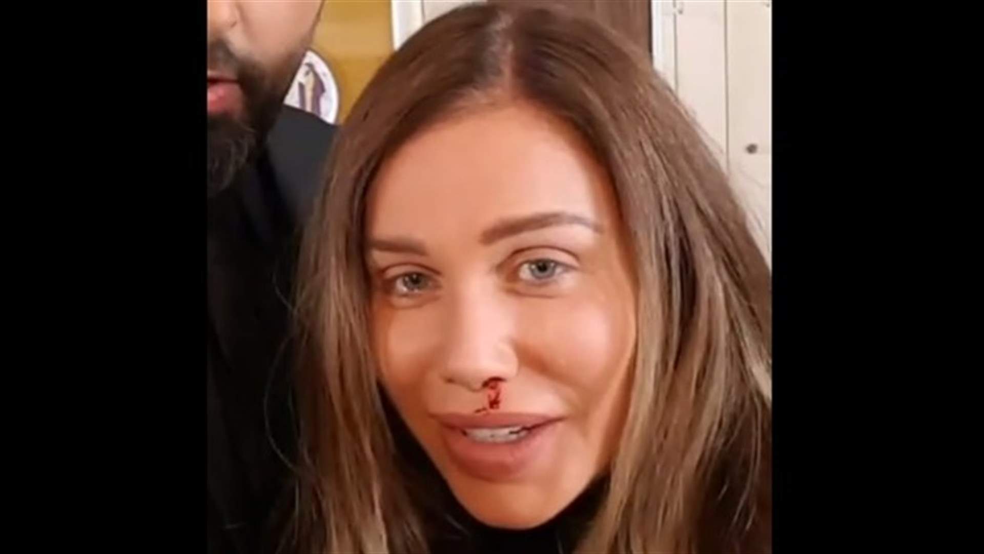 بالفيديو: نيكول سابا "أكلت قتلة".. والدم يسيل من أنفها
