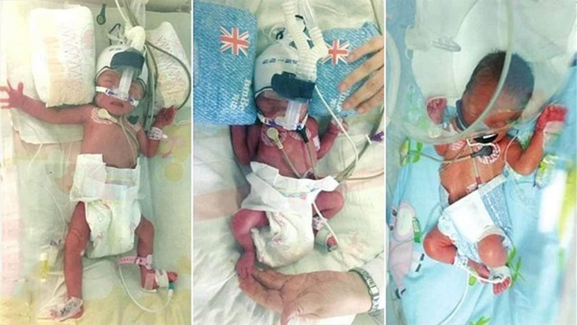 قصة خارجة عن المألوف... سيدة تنجب مرتين في غضون 7 أيام!