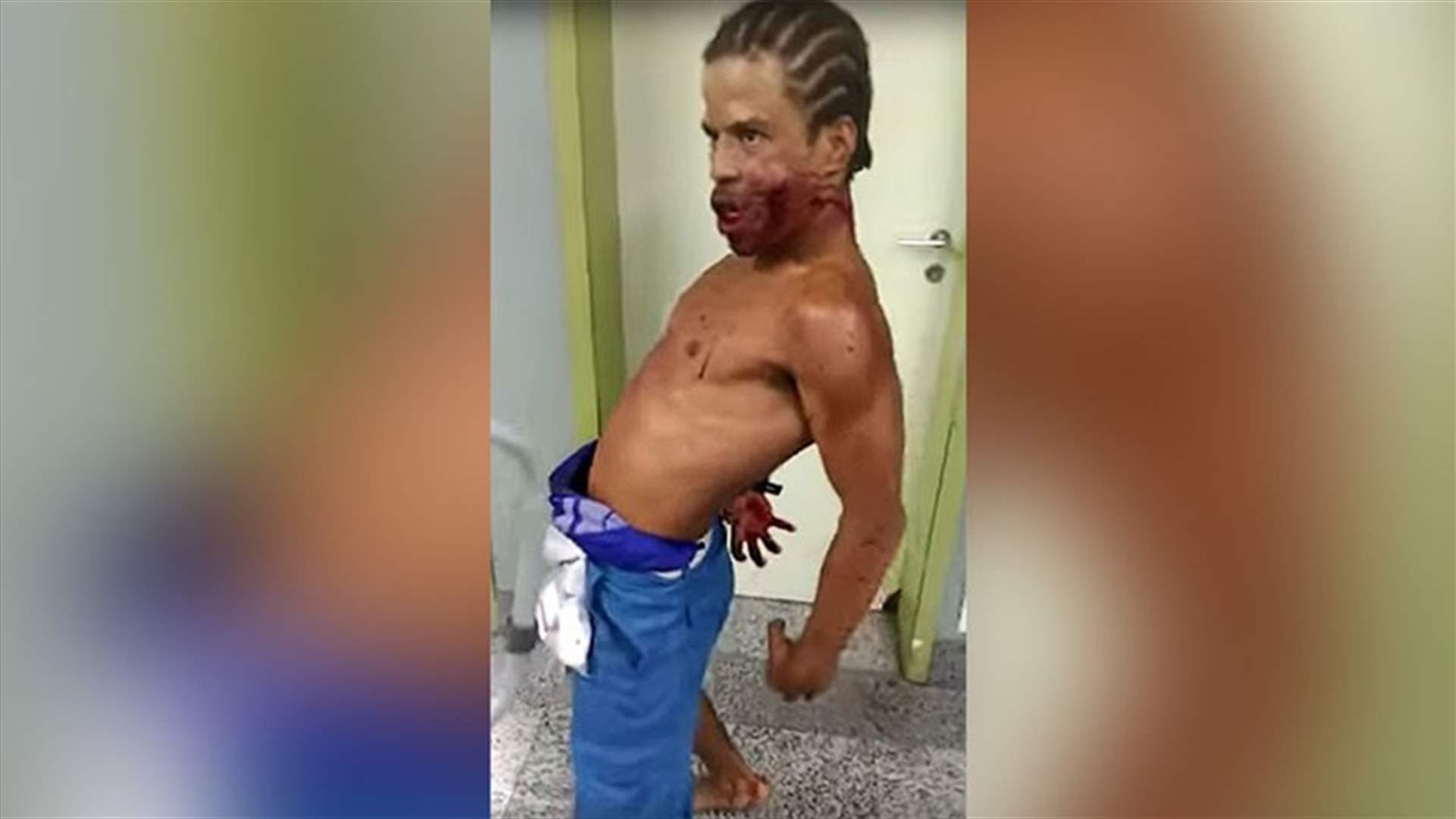 رجل بطلقة نارية في خدّه يُرعب طاقم عمل المستشفى بتصرّفات "شيطانيّة"!