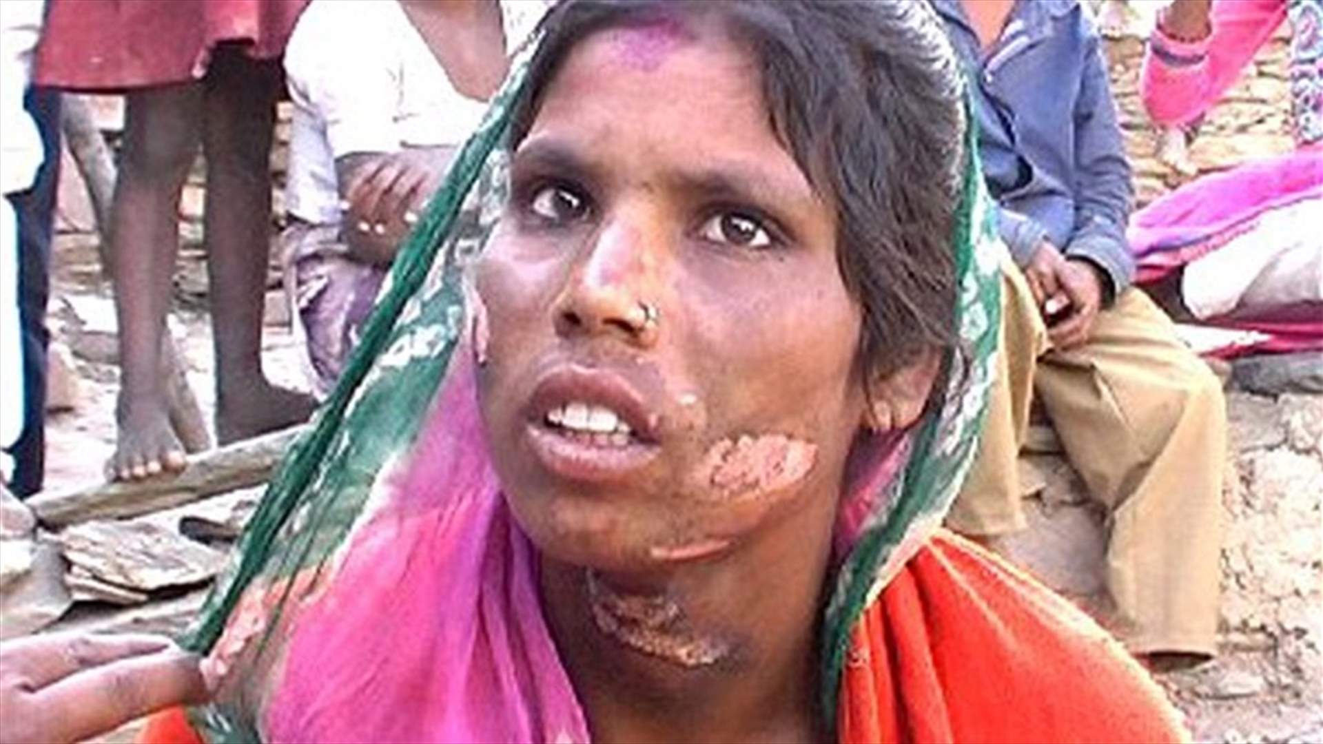 أحرقها في الأماكن الحساسة... ظناً منه أنها على علاقة برجل آخر!