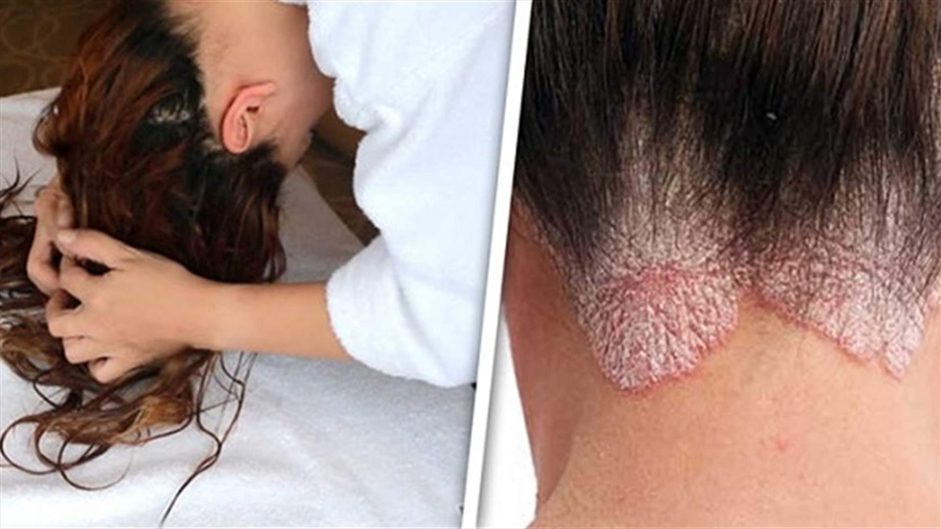 إحذروا النوم بشعر رطب... قد تصابون بهذه الأمراض!