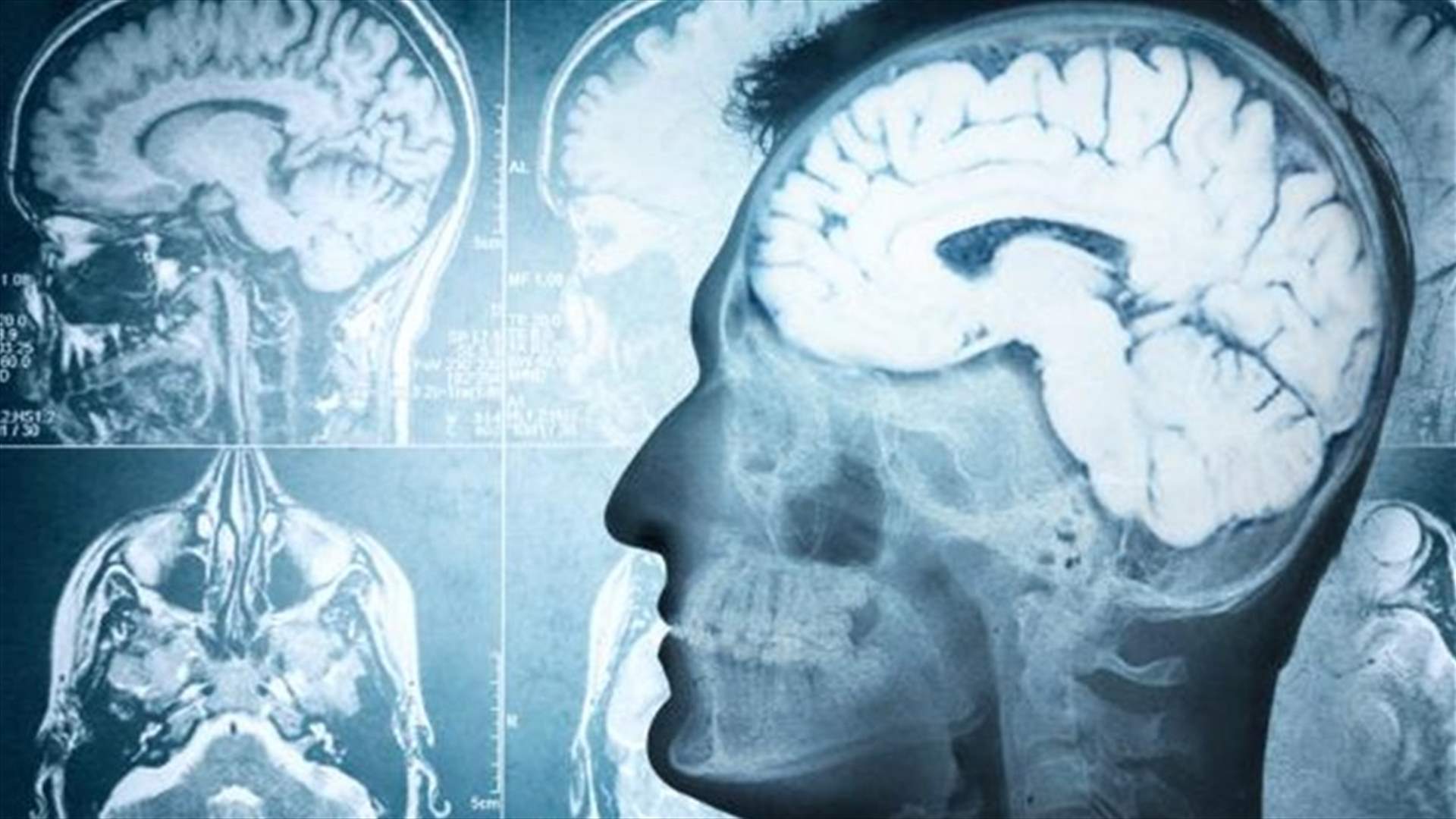 إصابات الرأس تتسبب بأضرار خطيرة للدماغ!