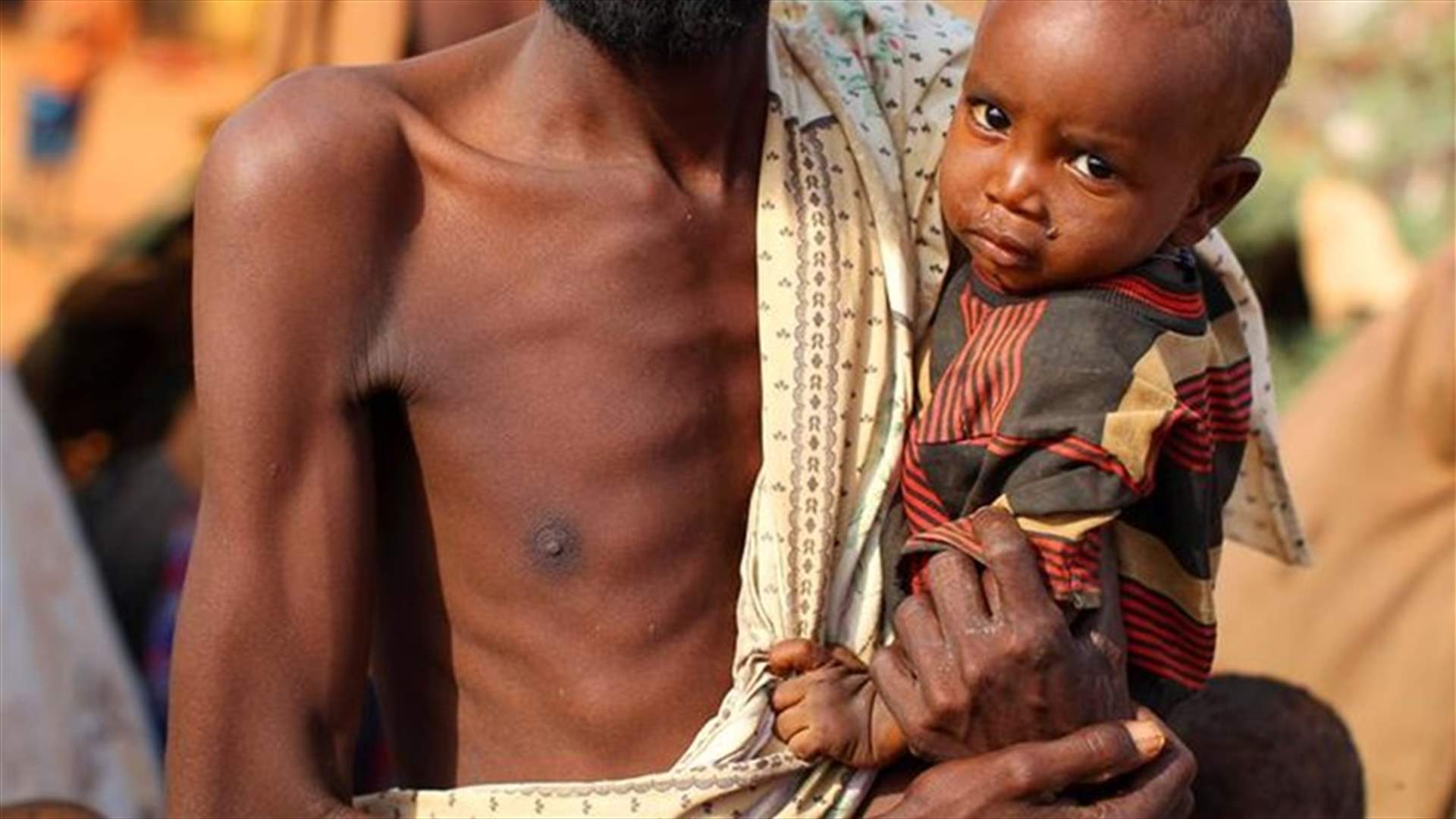 الجوع بدأ يقتل السكان في الصومال...