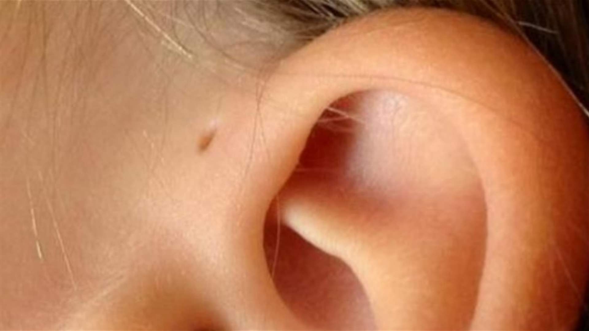لماذا يوجد ثقب صغير بجانب أذني بعض الأشخاص؟