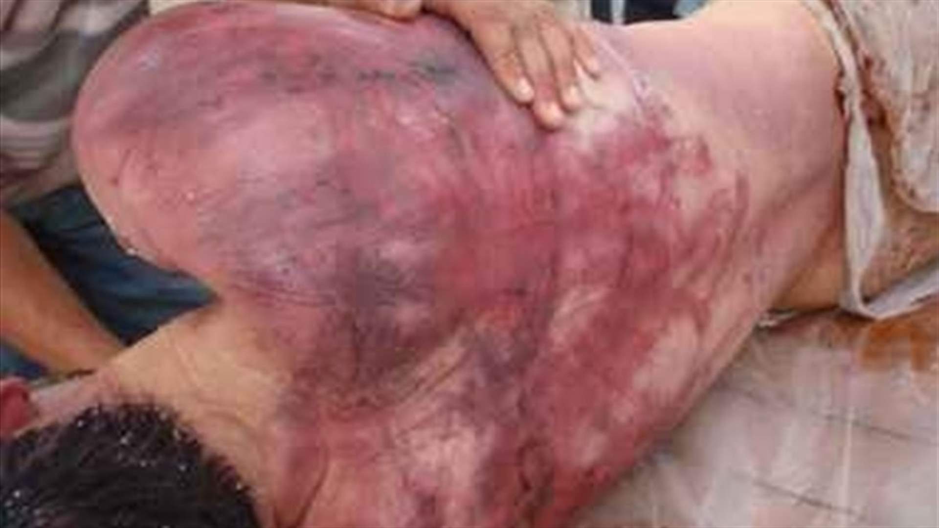 Human Rights Committee approves anti-torture draft law