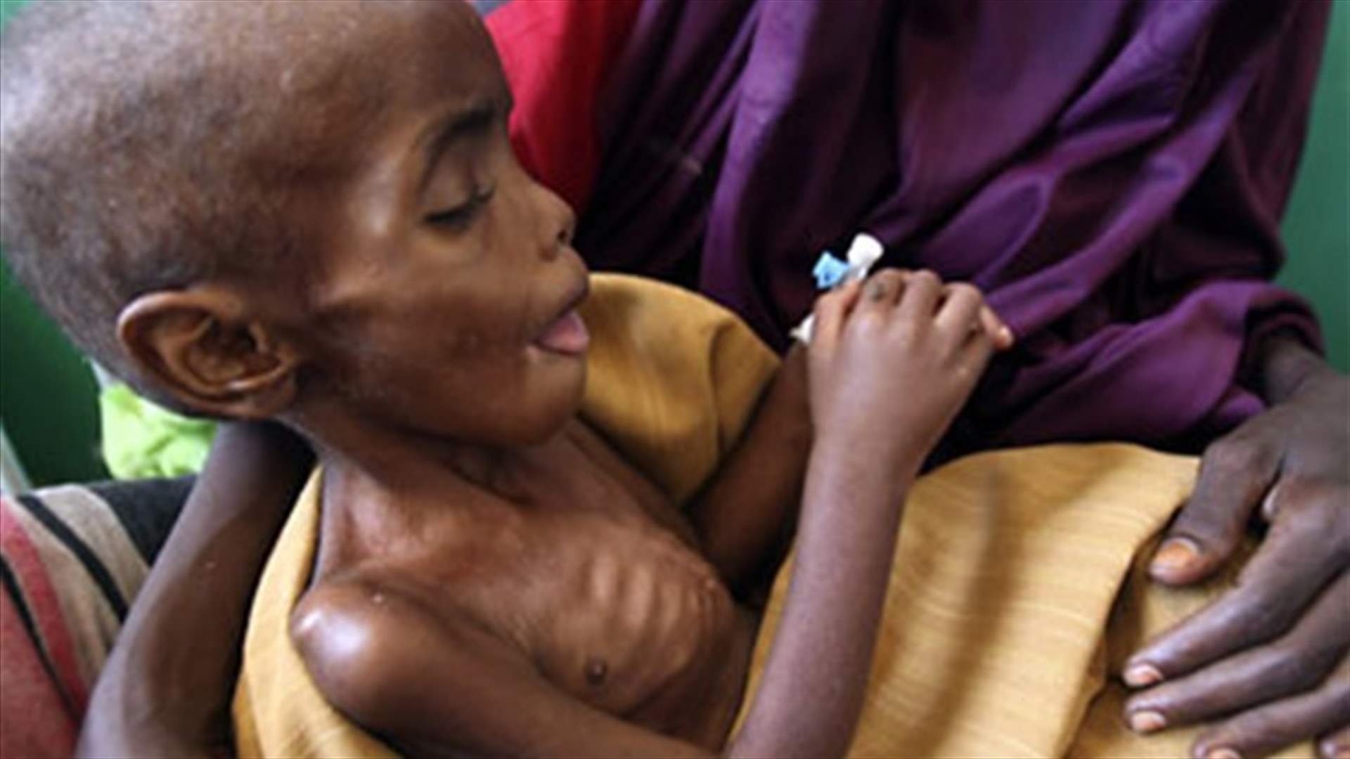 Risk rapidly rising of mass starvation in Africa, Yemen -UN